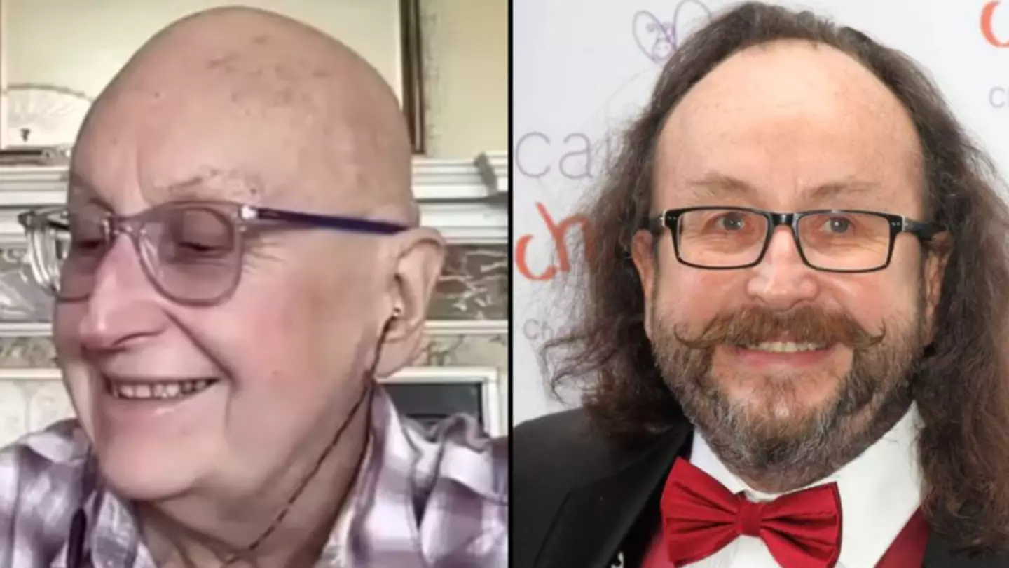 Hairy Bikers' Dave Myers says he's lost iconic beard in cancer update