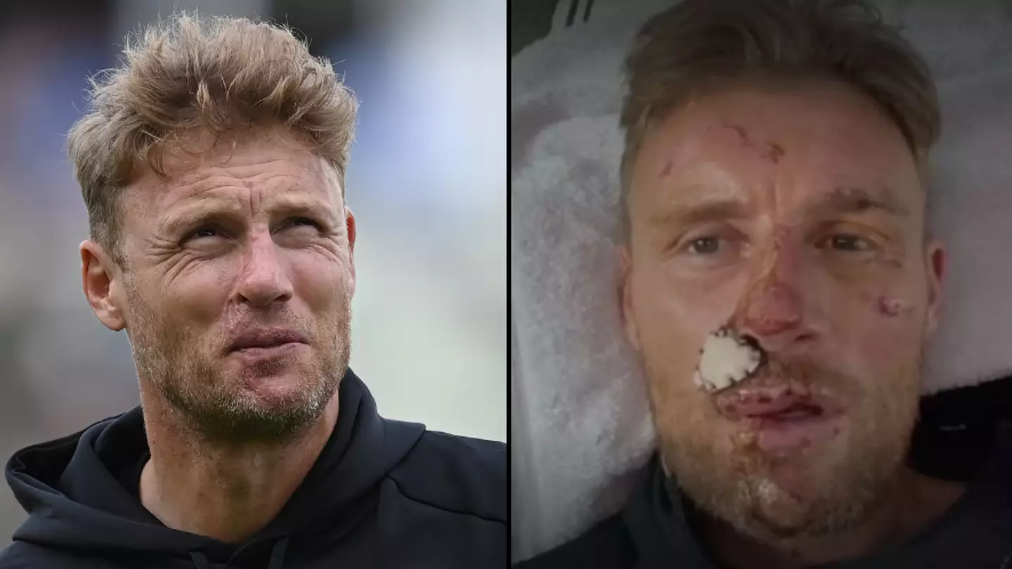 BBC issued full apology and compensation payout following Freddie Flintoff's horrific Top Gear crash