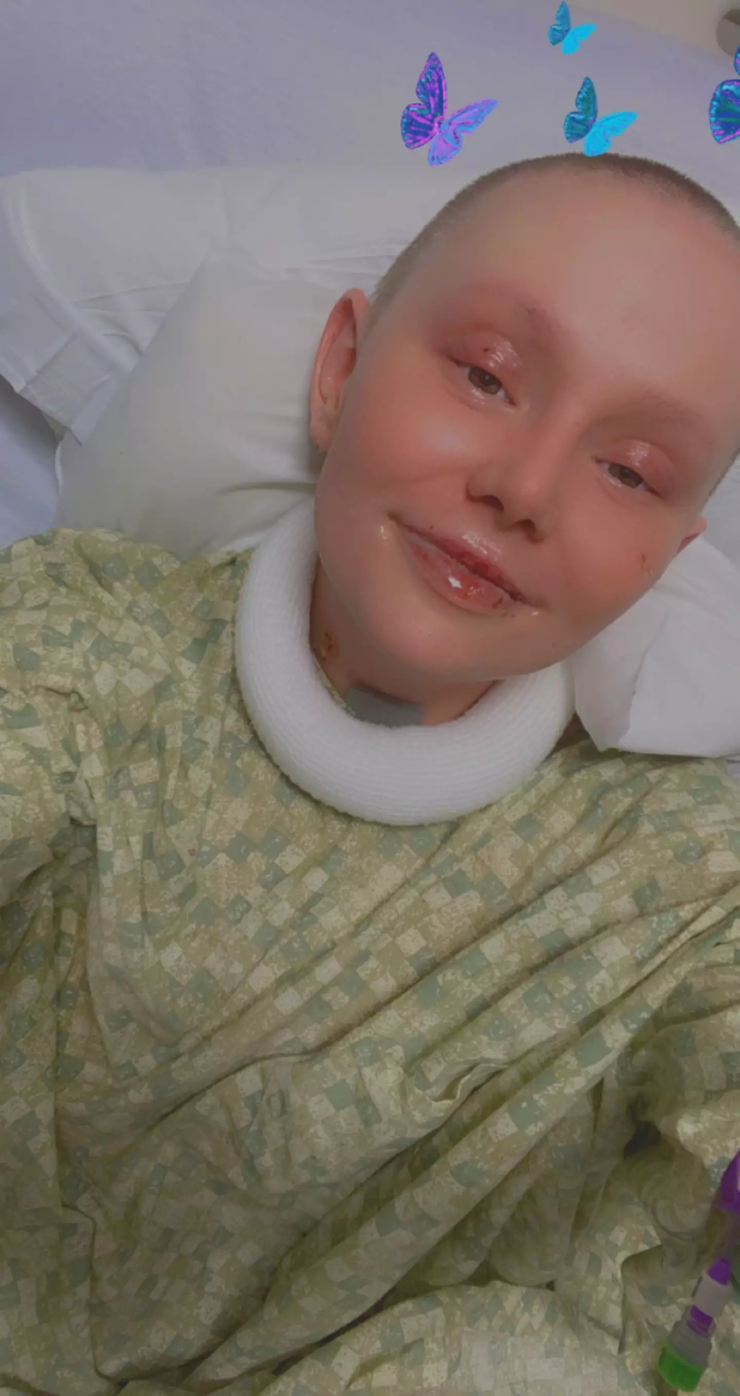 The mum-of-three is still experiencing complications related to SJS (Kennedy News and Media)