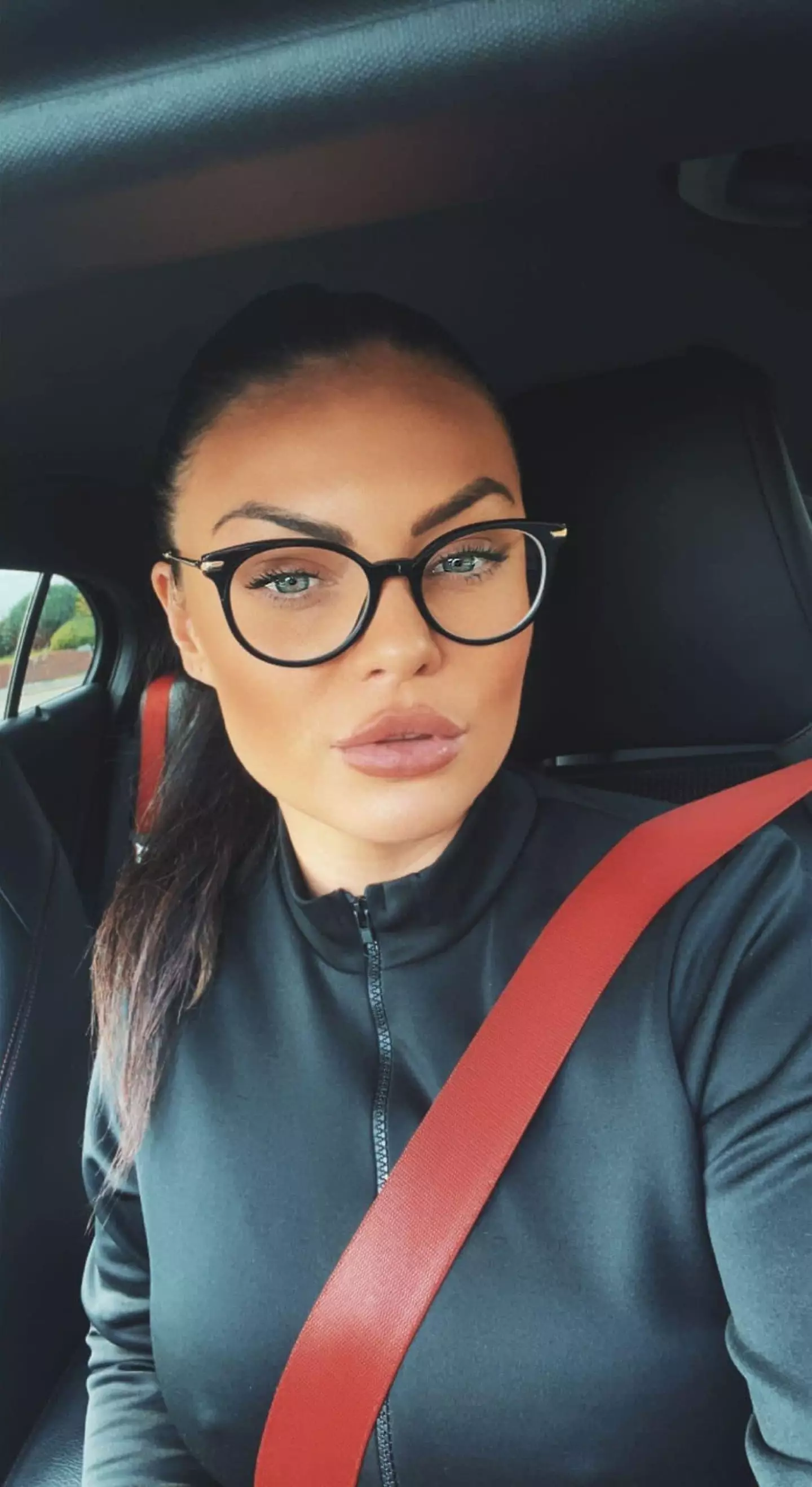 The rottweiler-pitbull cross latched onto Kelsea's face after it 'saw red'.