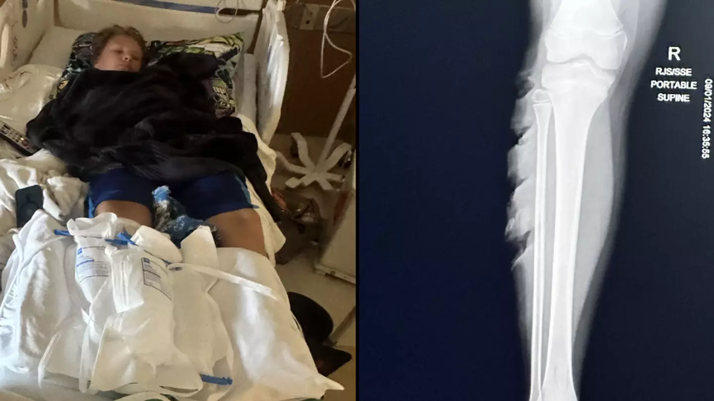 Mum feared son ’wouldn’t make it’ after having leg sucked into boat propeller in ‘horrifying’ accident