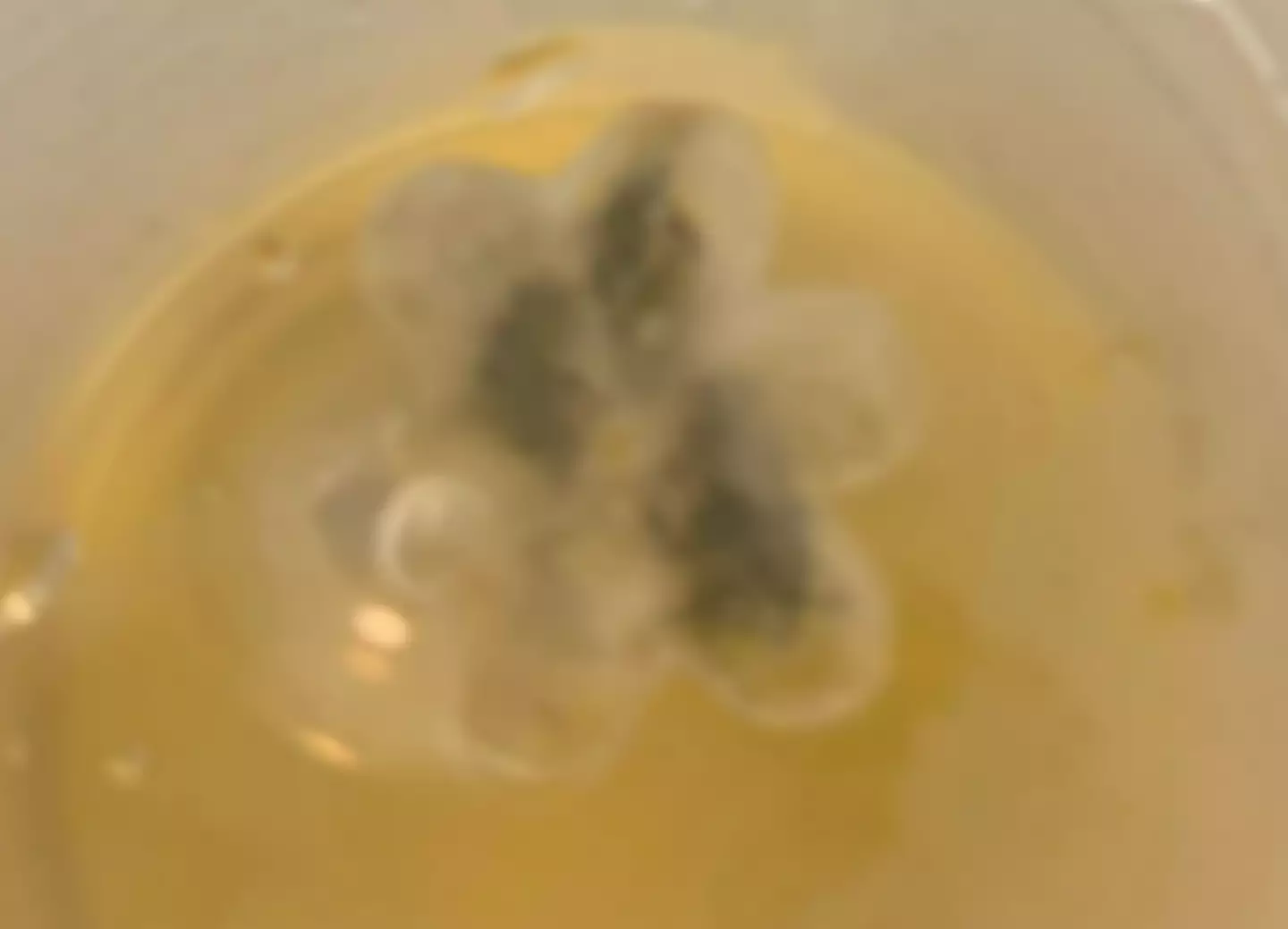 Doctors discovered a small plastic flower lodged in Marley's throat.