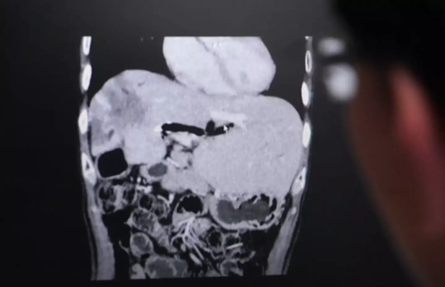 It's a dangerous dish, but some people don't want to change their eating habits (BBC)