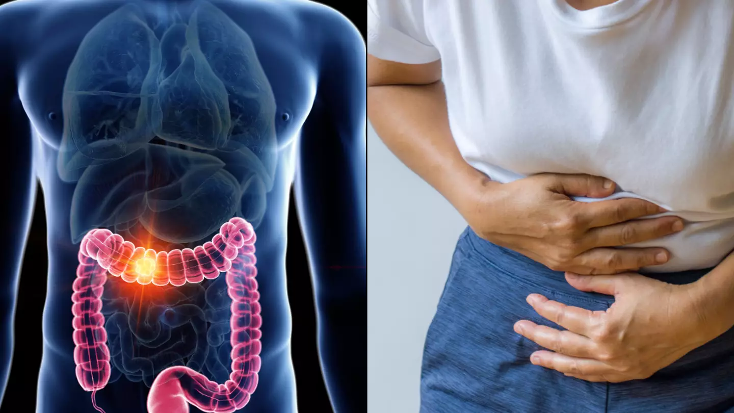 Doctors issue warning of three new factors driving certain cancer type as cases skyrocket in young people