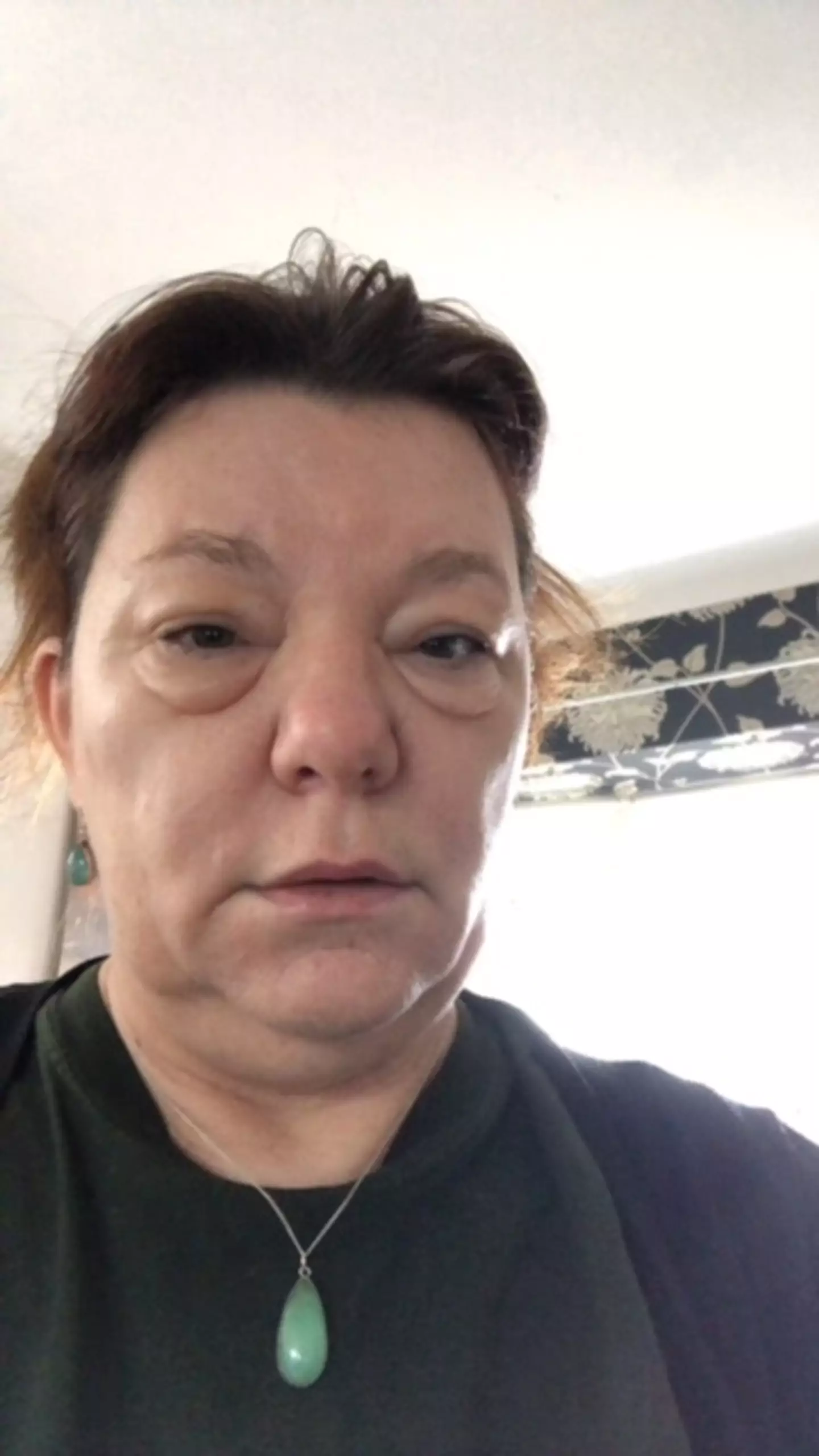 Lizzie had bags under her eyes and didn't know why (Lizzia Spear / Leukaemia UK)