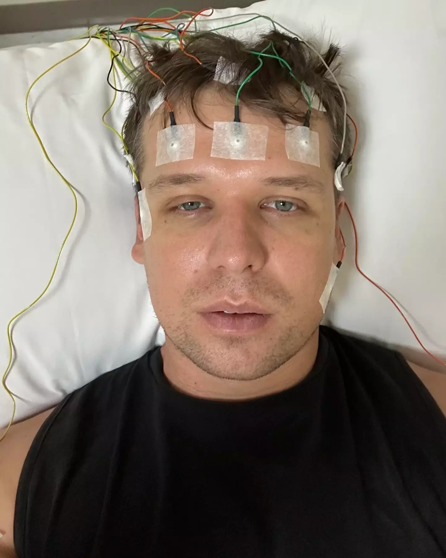 Oliver said he has been in a 'waking nightmare' since his sleep struggles began in December 2023 (Reddit/Oliver_Alvis)