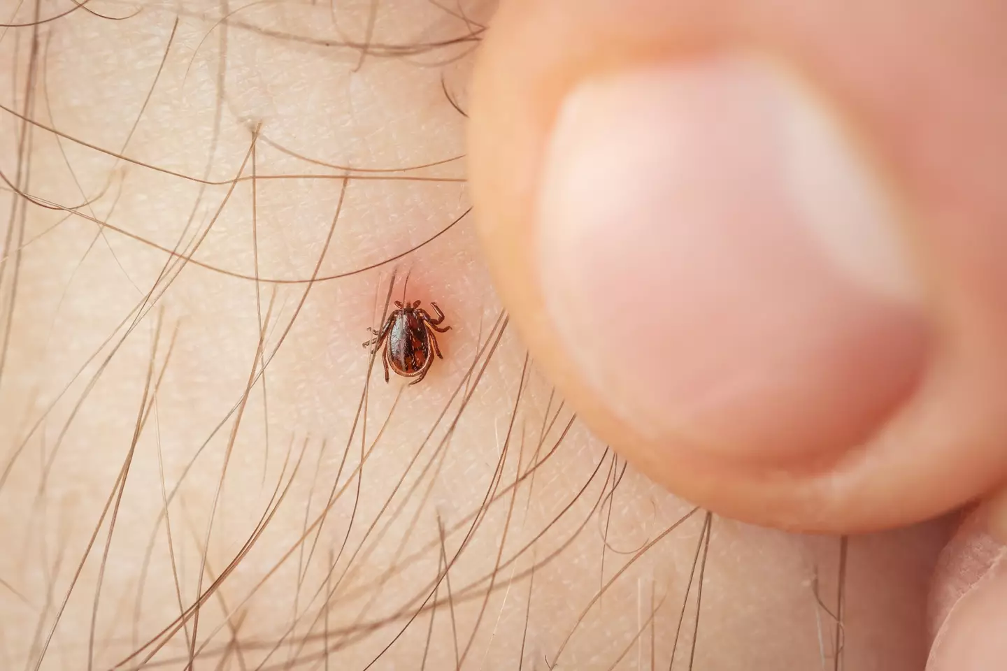 Not all ticks carry Lyme disease, but you should get yourself checked out regardless if you find one on you (Getty Stock Images)