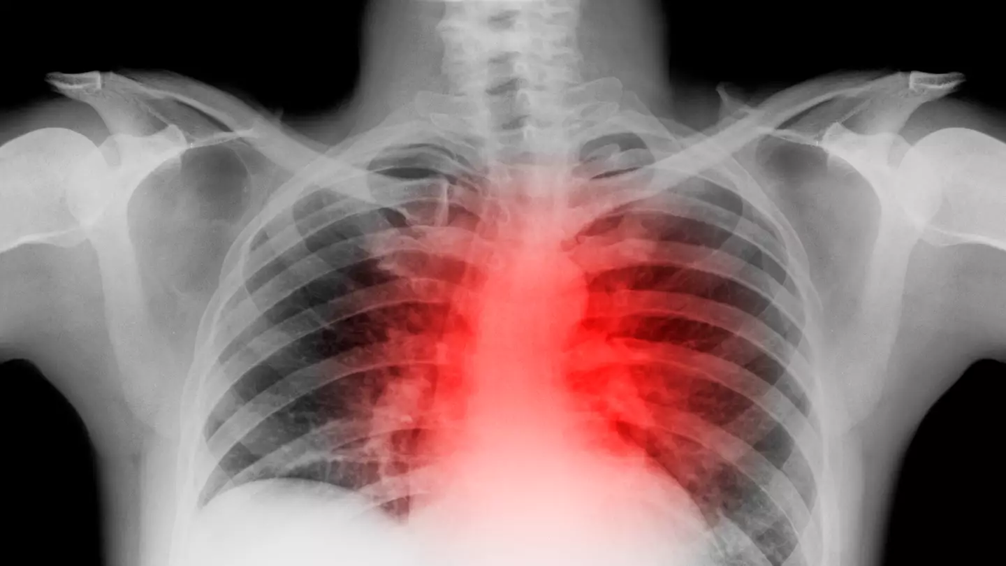 Cardiologist who had heart attack warns people to not 'make same mistake' over little-known warning sign