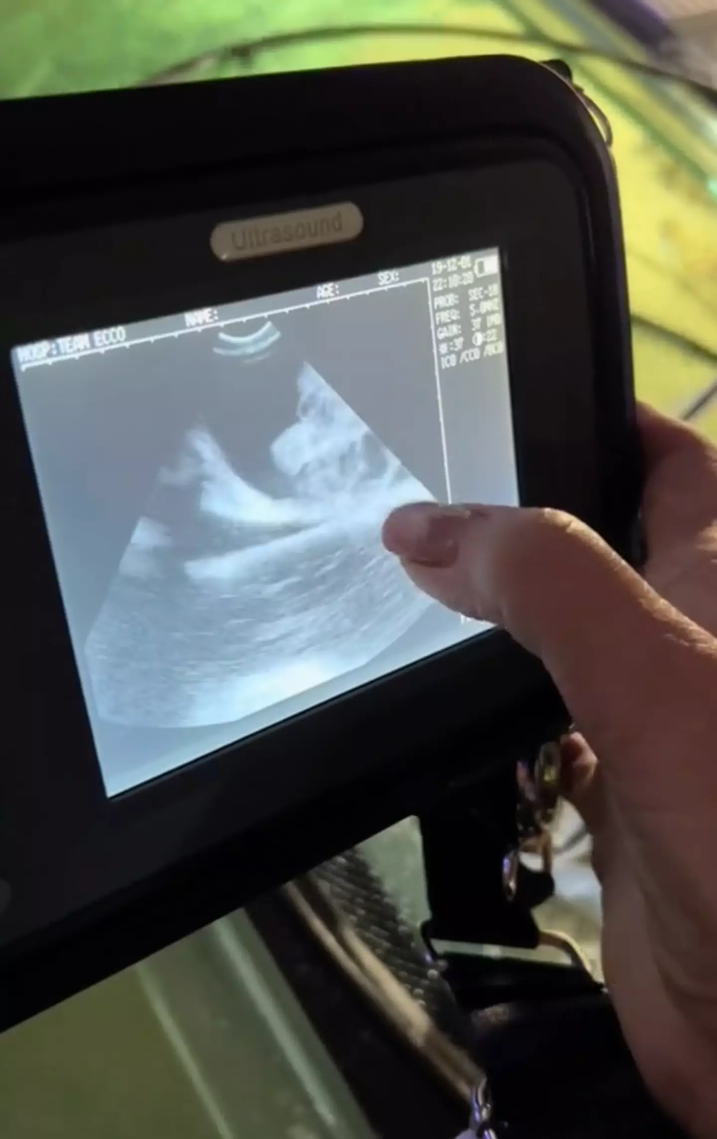 The team shared a recent ultrasound.