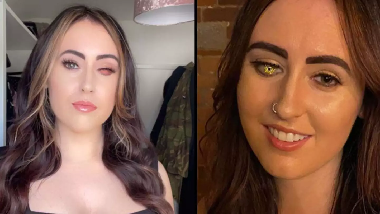 Woman Gets 'Golden Eye' After Cruel Comments About Missing Eye While Working As Barmaid
