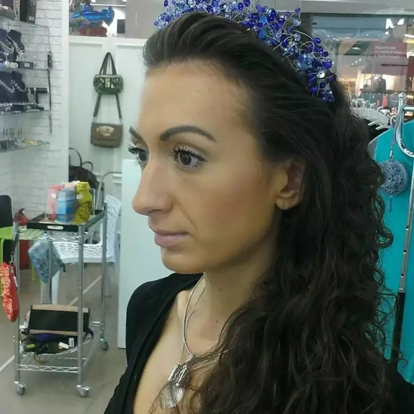 Here's how Anastasia looked before her surgeries.