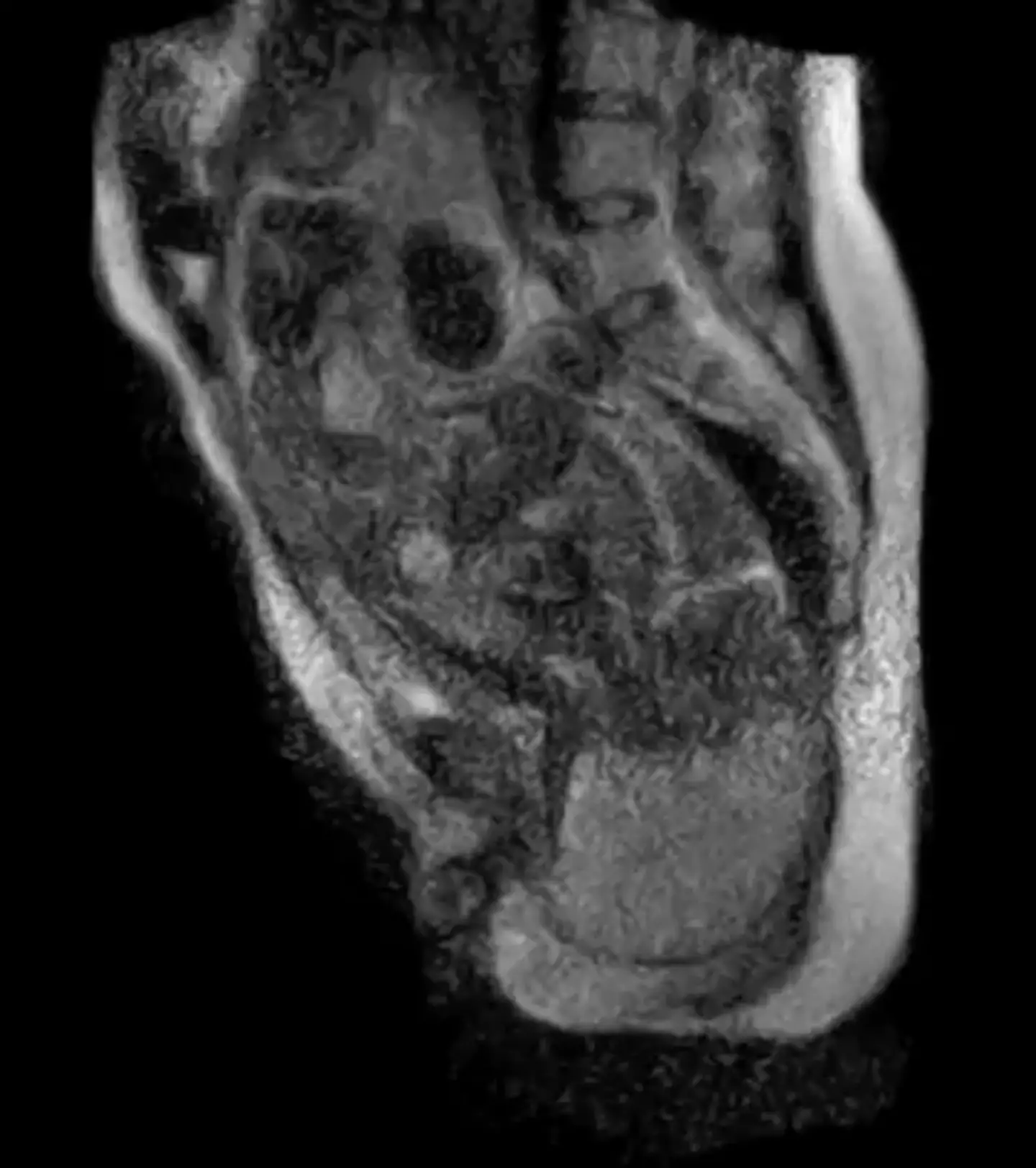 Over 15 years from its release, the imaging continues to be fascinating (YouTube/unecesarean)