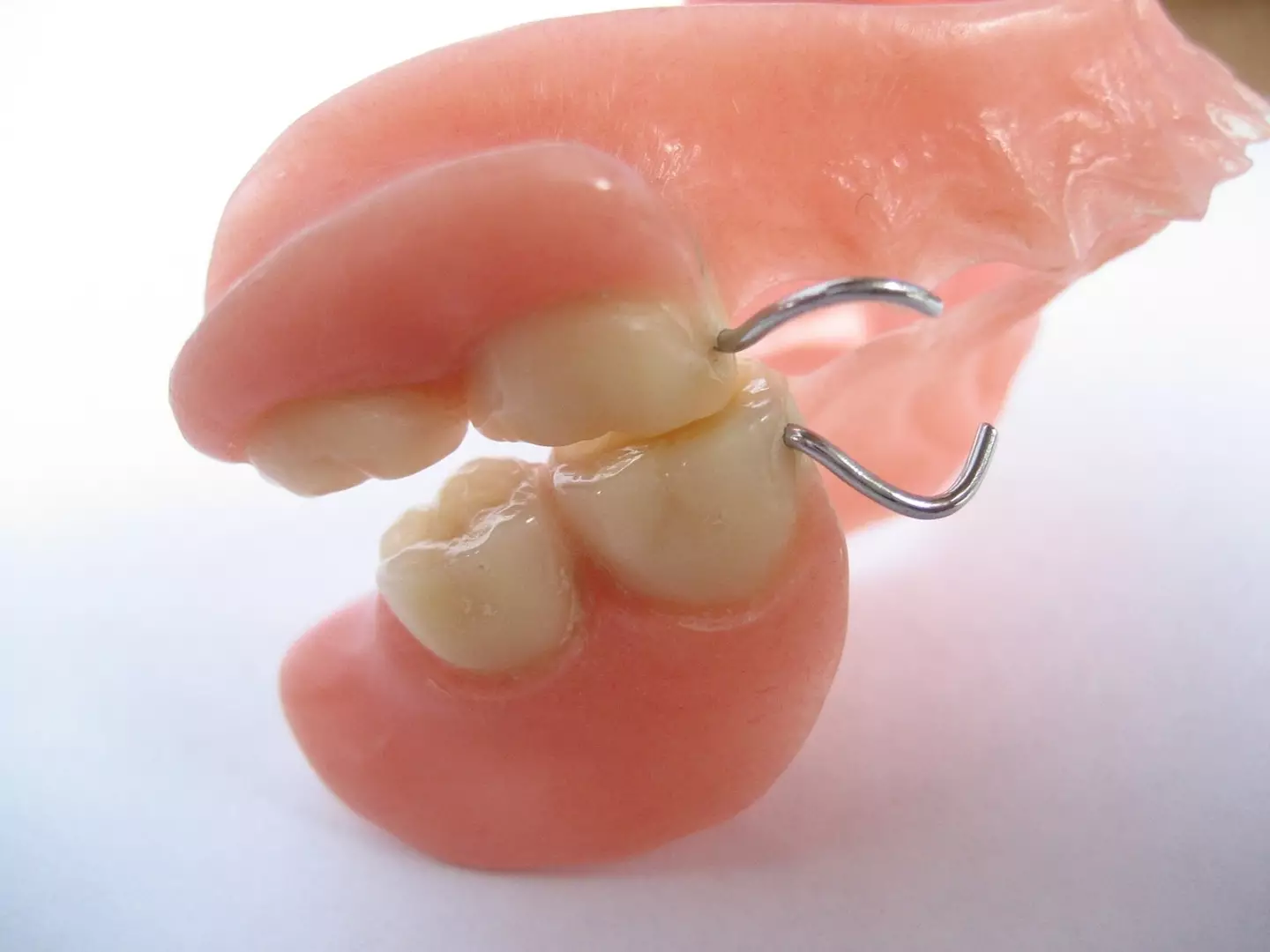 One caller got in touch after losing their dentures.