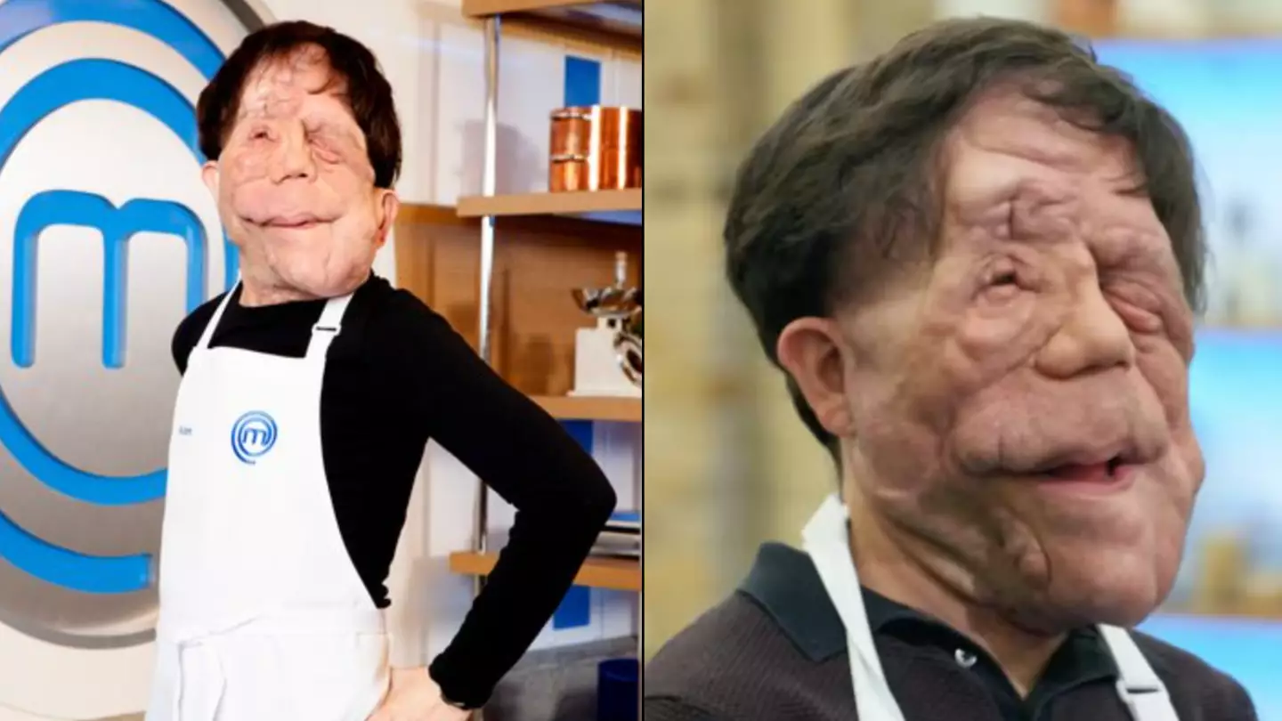Celebrity Masterchef contestant Adam Pearson issues sarcastic apology after appearing on show