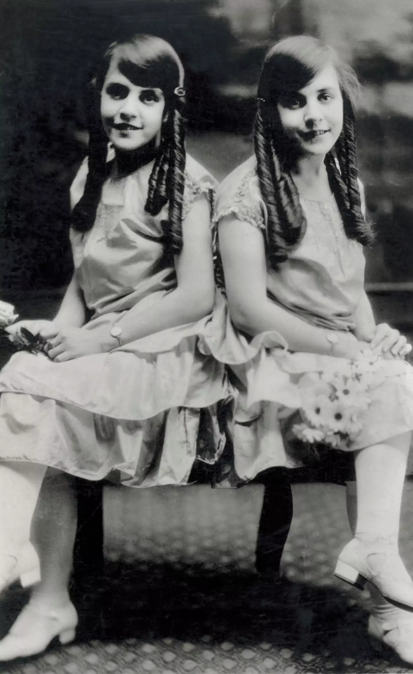 The twins pictured in 1924. (Universal History Archive/Universal Images Group via Getty Images)