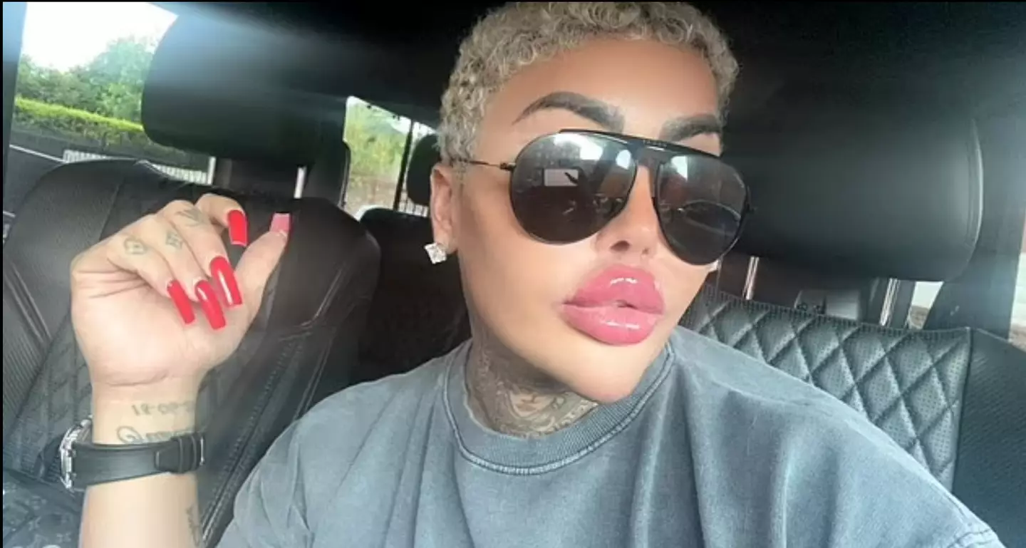 Jordan Parke describes himself as 'The Plastic Surgery Advocate'. (Facebook)