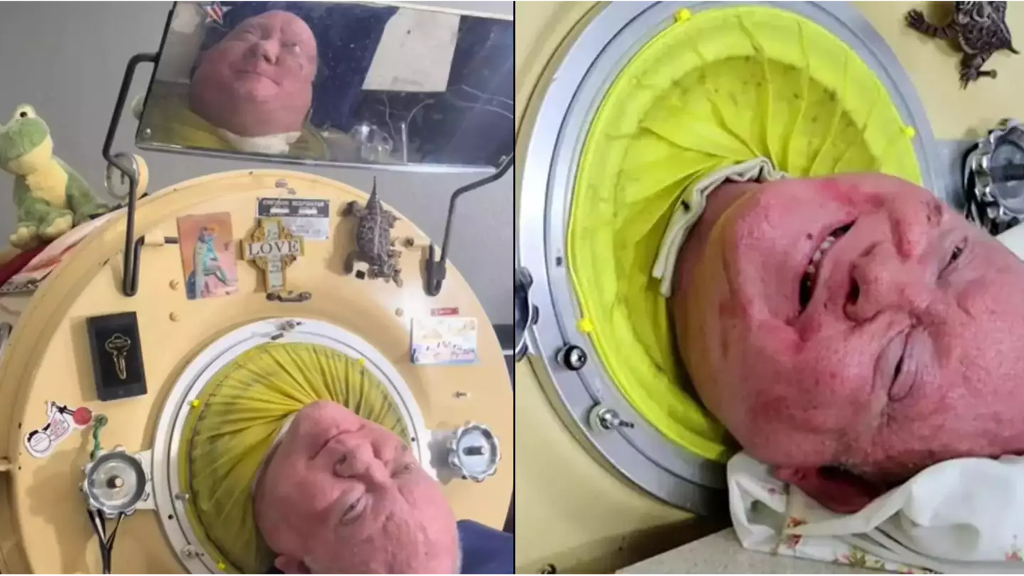 How it was possible for man to survive inside 'iron lung' for 70 years