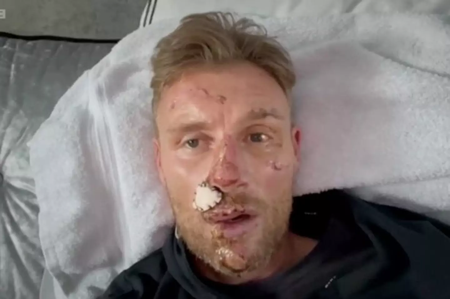 Flintoff shared more graphic snaps of his accident earlier this year (BBC)