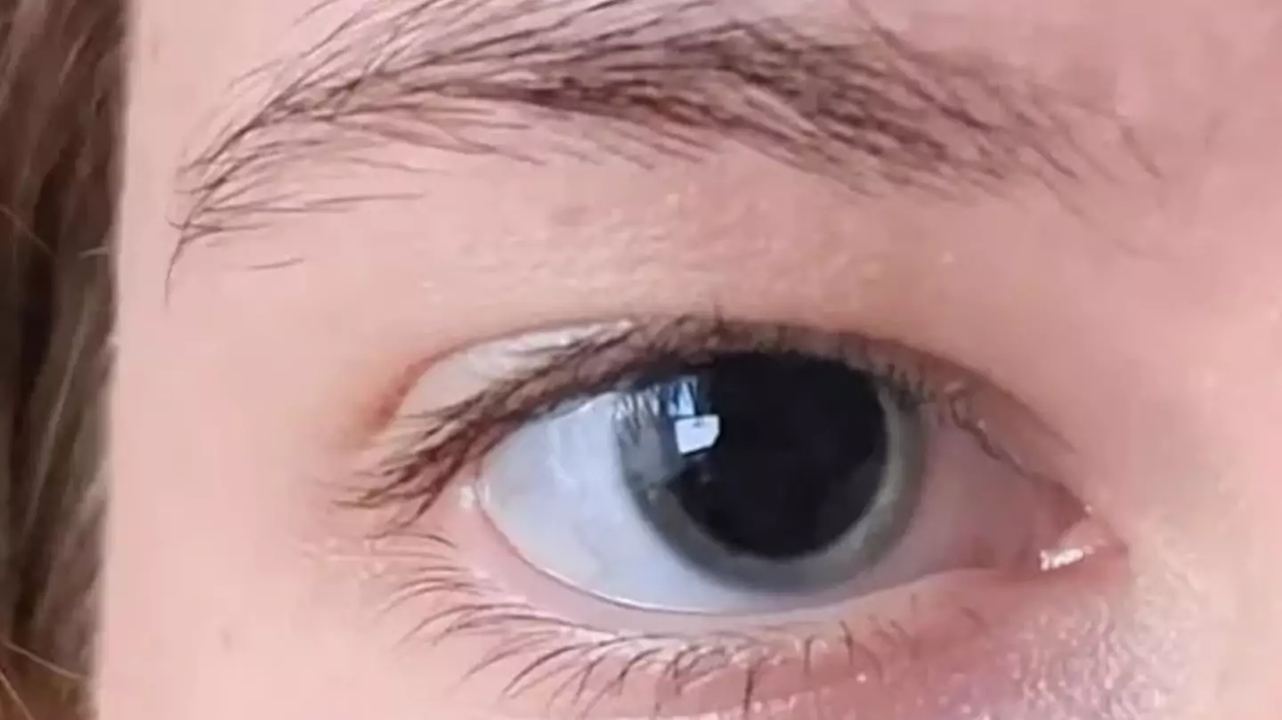 Woman has 'life saved by strangers' after posting photo of her eye on social media