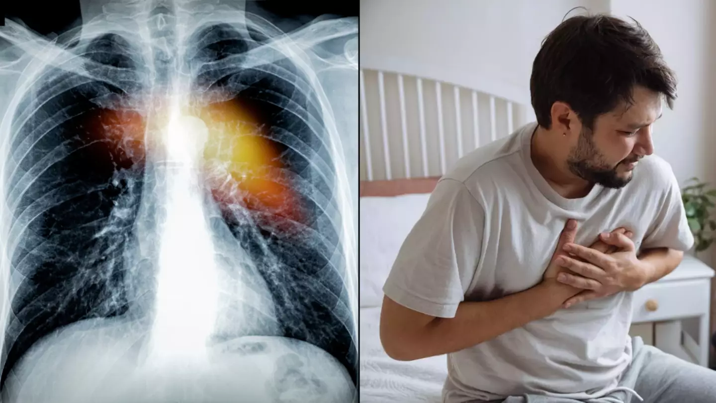 Doctor's warning over certain sleeping position that could be sign of deadly heart failure