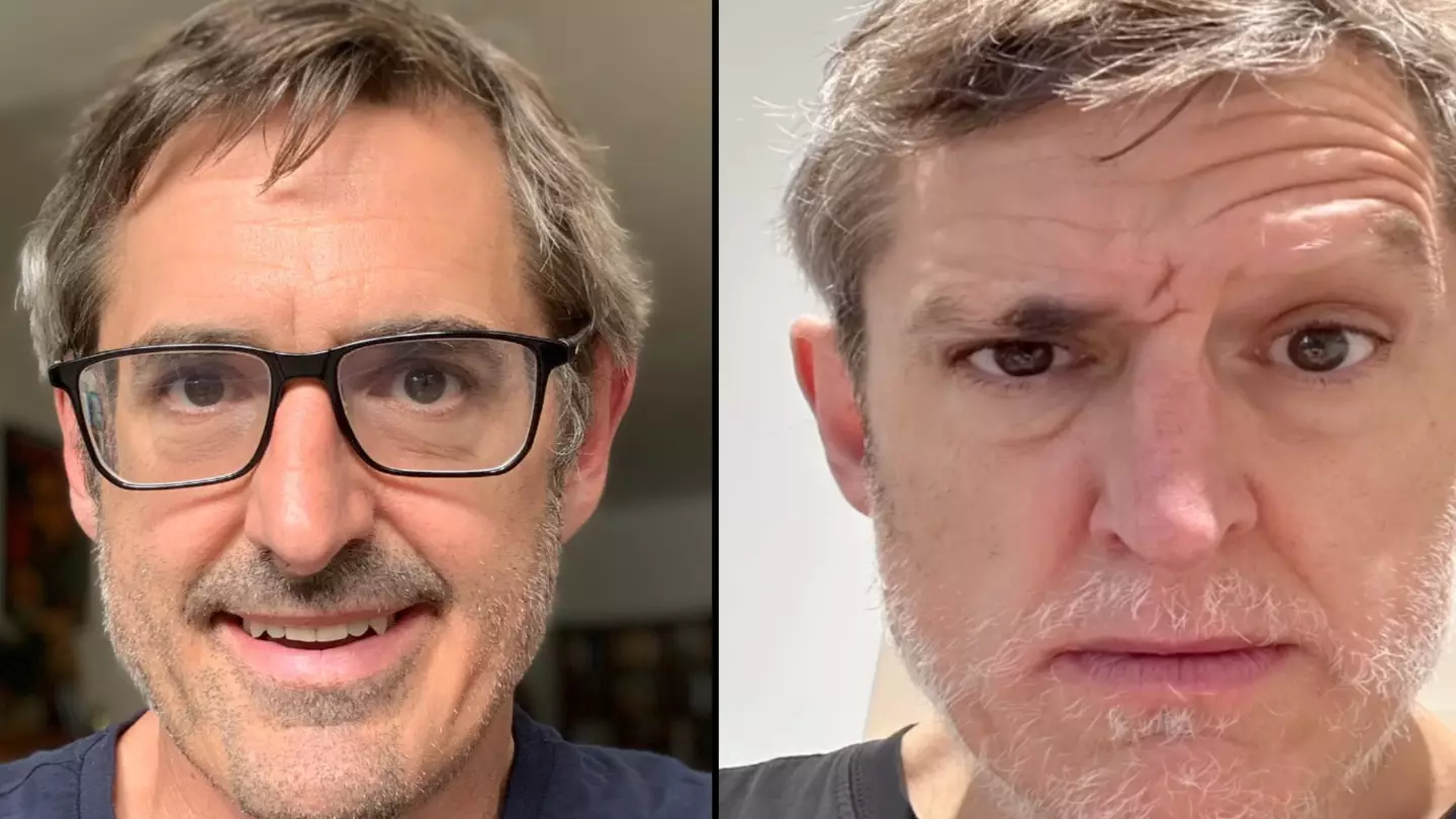Louis Theroux asks fans for help as he shows changing face from alopecia battle