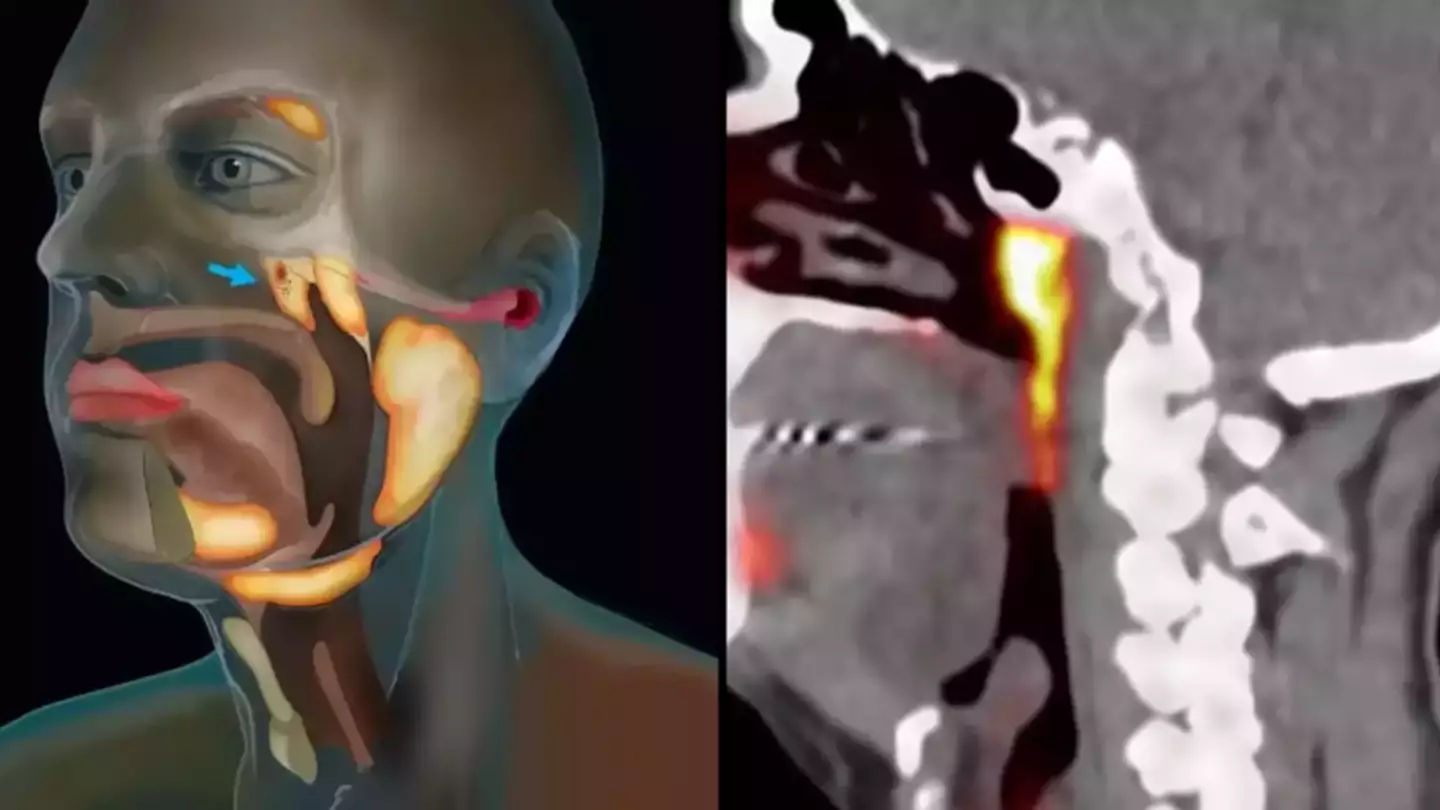 Scientists accidentally discovered brand new organ in the human body never seen before