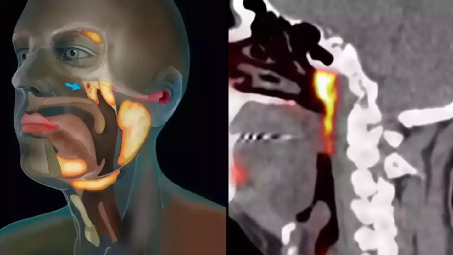 Los científicos han descubierto accidentalmente un nuevo órgano en el cuerpo humano que nunca antes se había visto