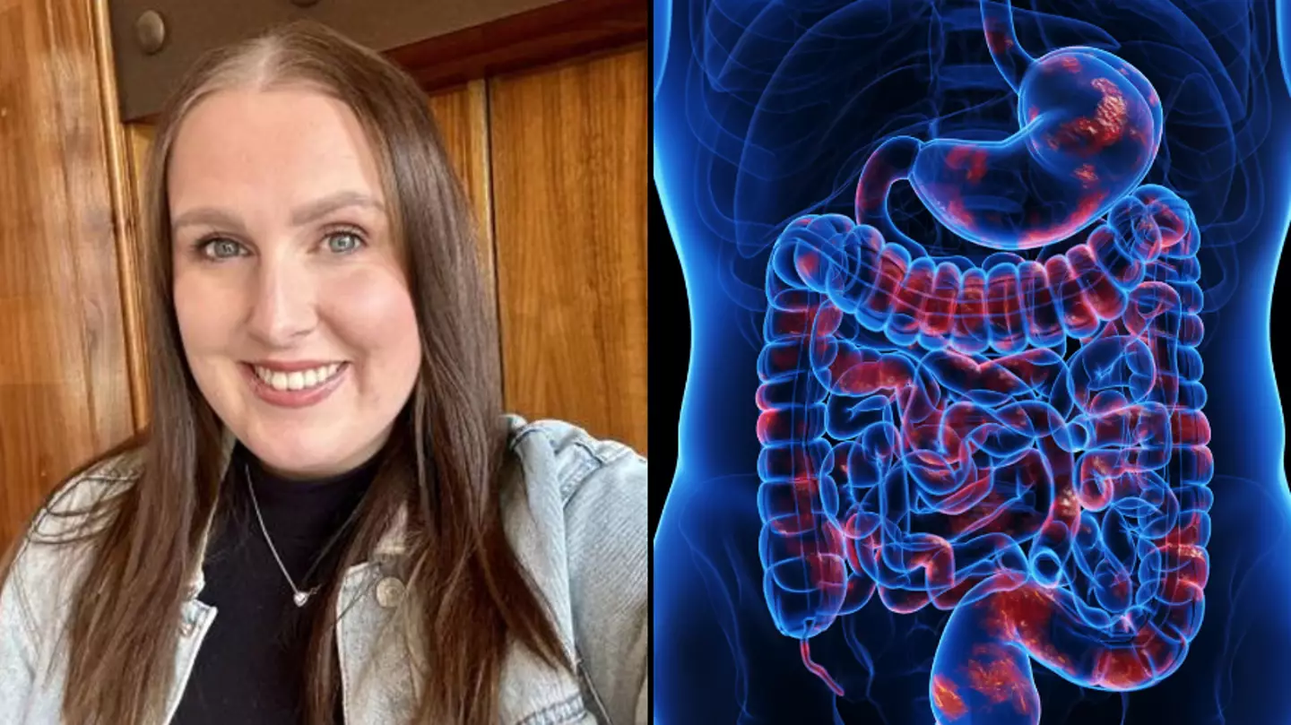 Woman living with inflammatory bowel disease explains 'hardest thing' about having condition