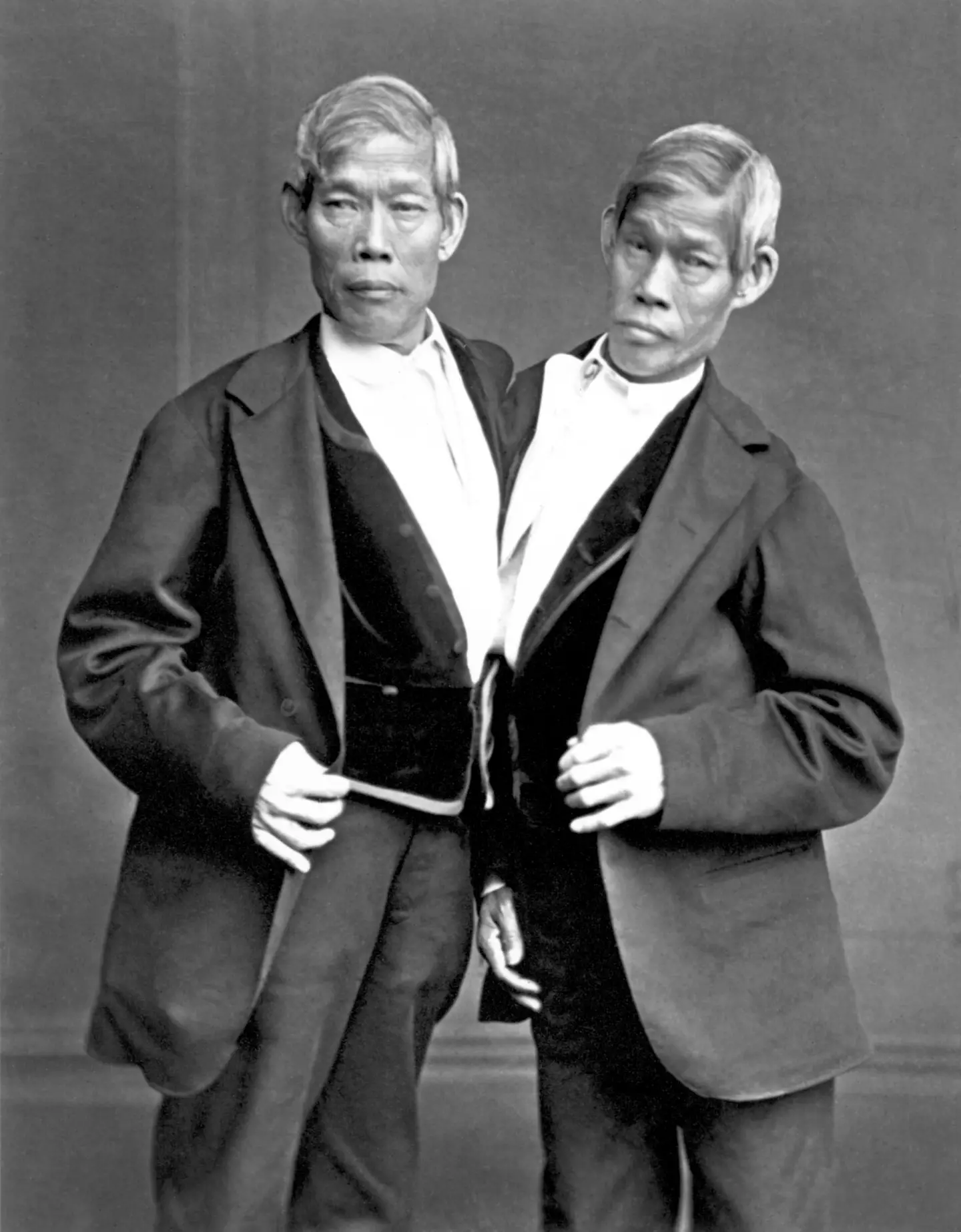 Conjoined twins Chang and Eng Bunker were arrested but not prosecuted, and we don't know whether they'd really have been able to be punished. (History/Universal Images Group via Getty Images)
