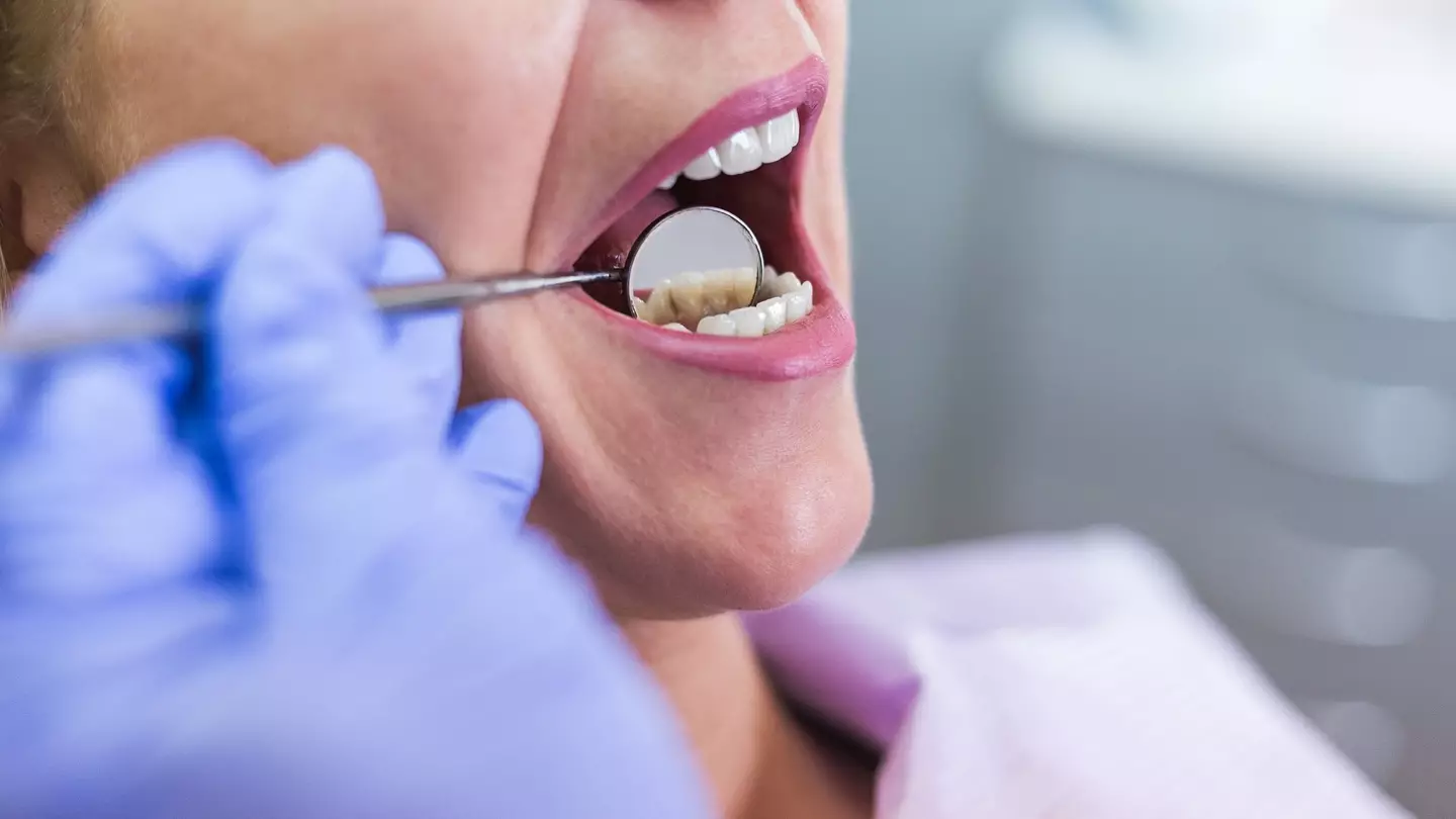 Dr Koh shared the stories to remind people about the importance of proper dental care. (Getty Stock Images)