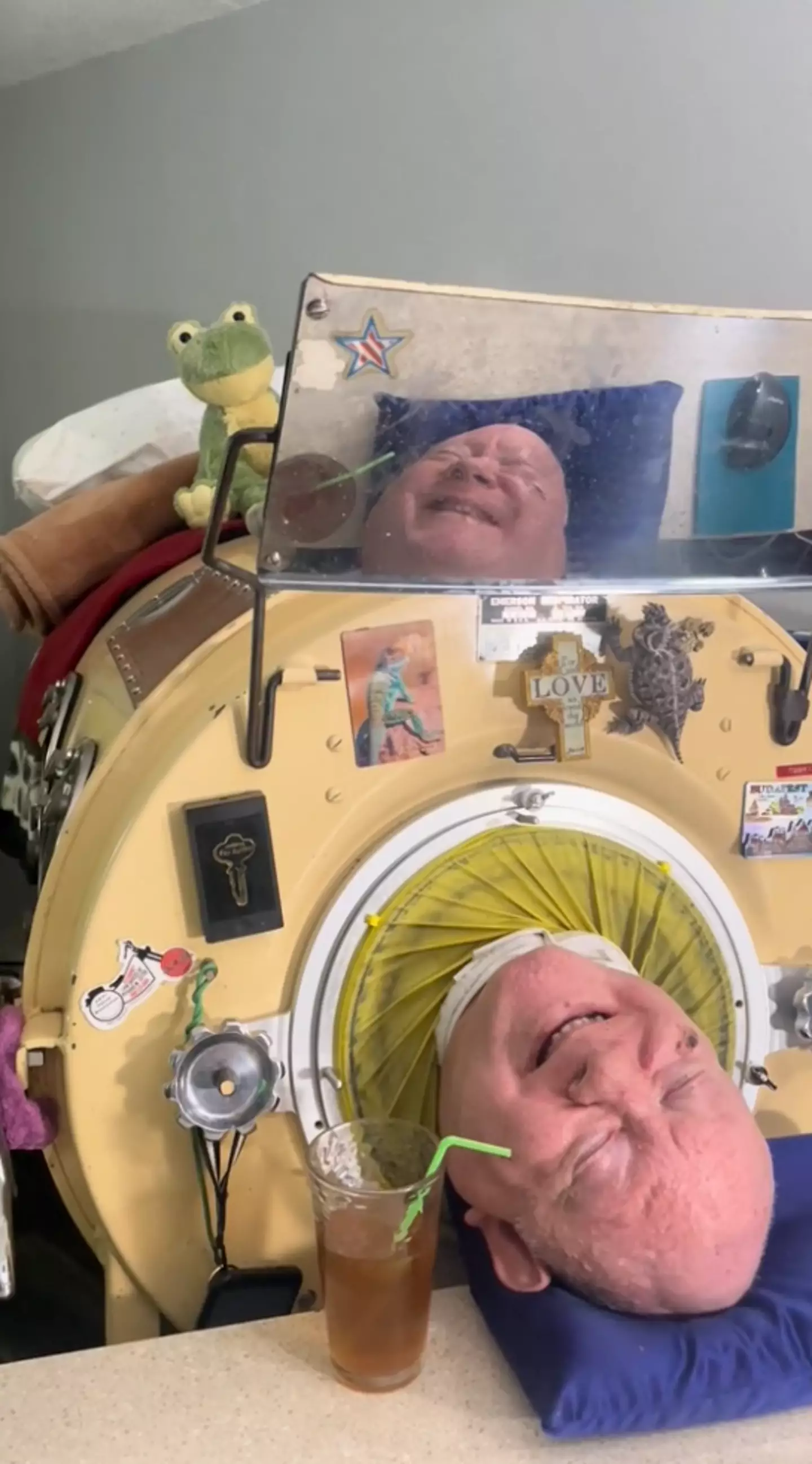 Paul Alexander has relied on his iron lung since he was just six years old.