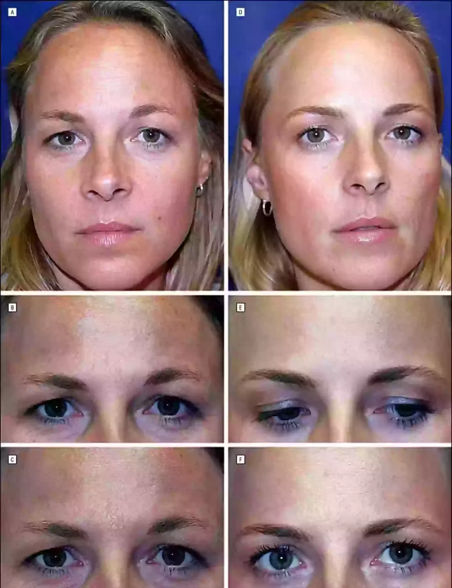 This is what the twins looked like at the start of the study (American Medical Association)