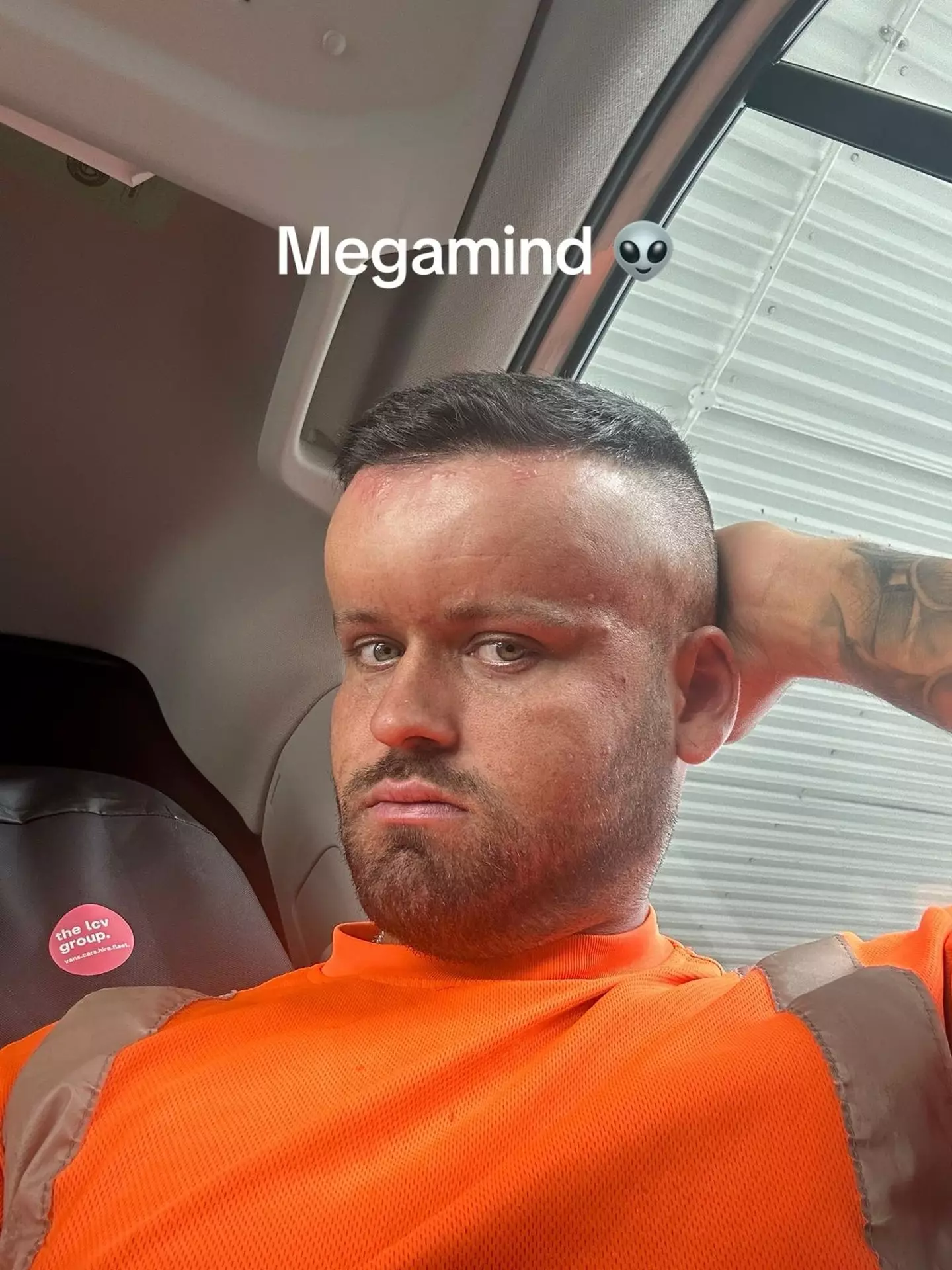 His head swelled up like a 'balloon' (Kennedy News and Media)