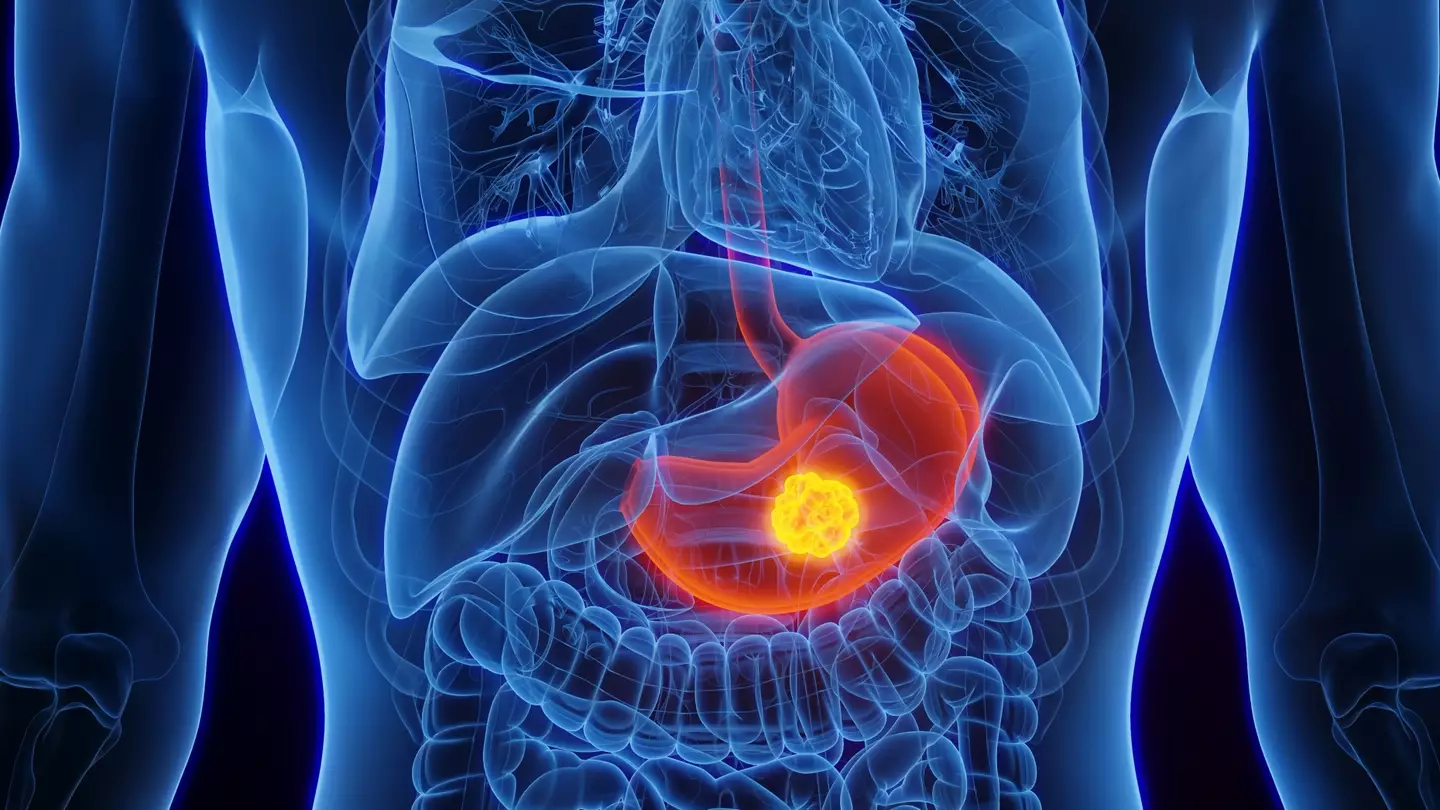 The gallbladder is located by your liver (Getty Stock Photo)