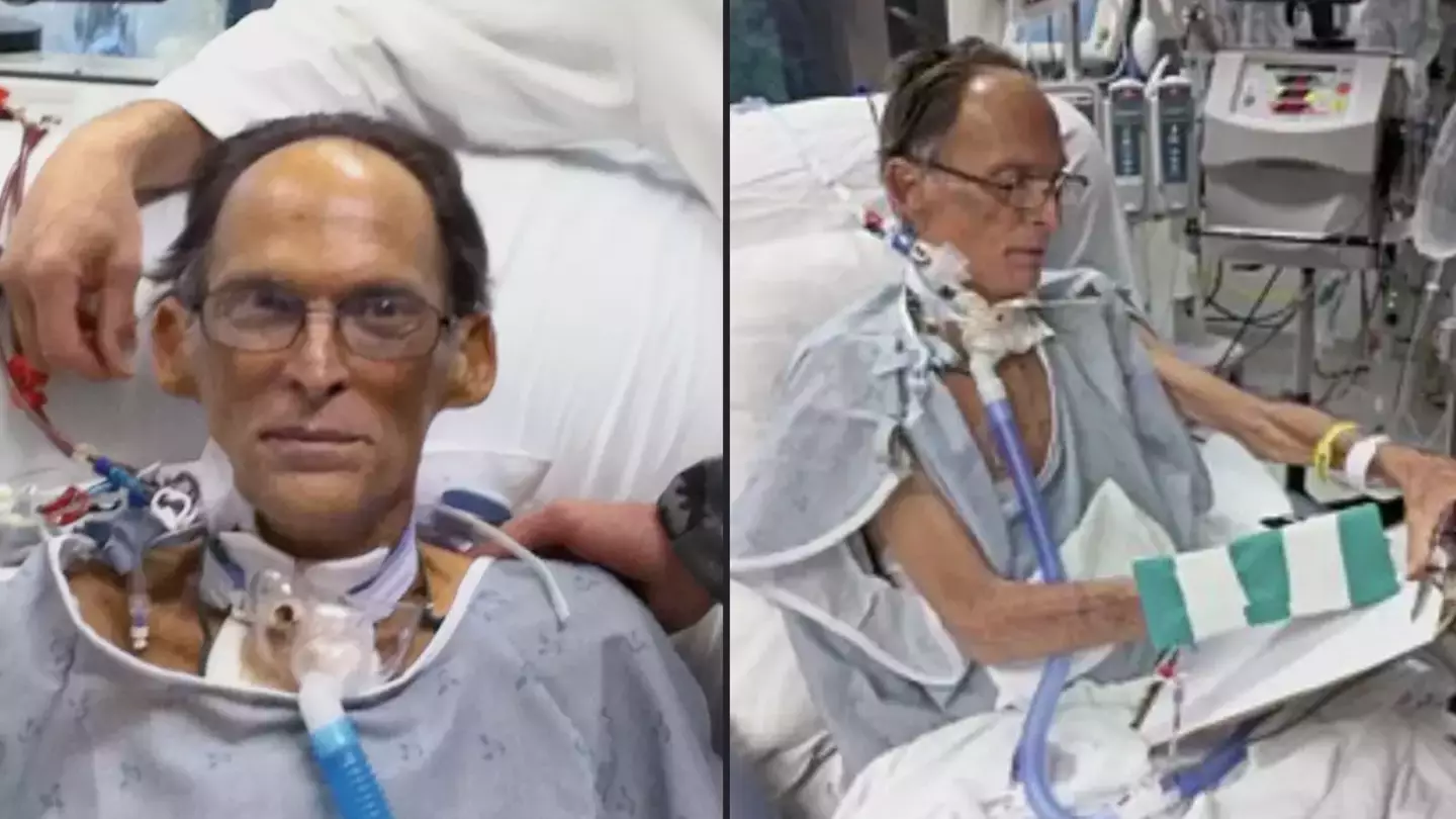 World's first heartless human was able to live without a pulse