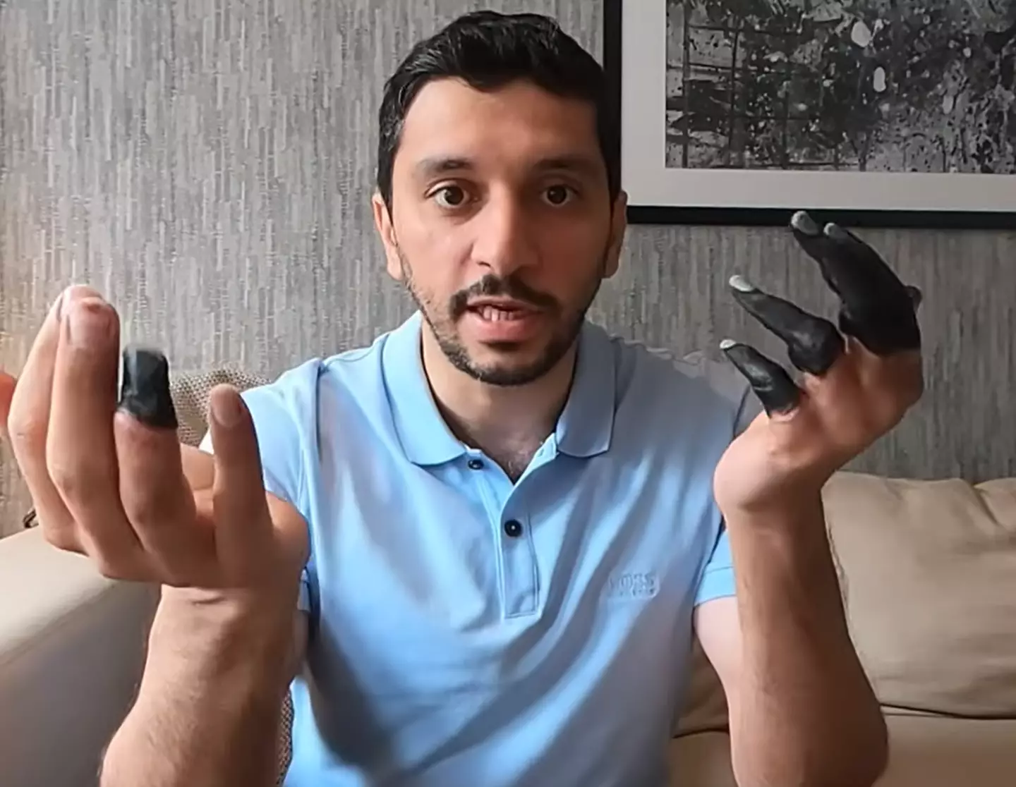 Mountain climber reveals challenges he faced using frostbite hand after hike almost cost him his life 1 The mountain climber showed what frostbite had done to his fingers. (YouTube/Fahad Badar)