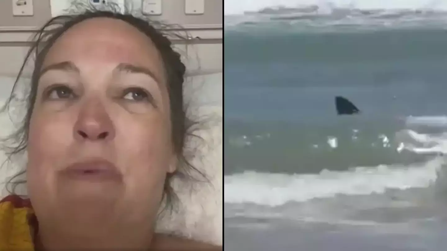 Shark attack victim recalls moment she was mauled after video captured horrifying moment blood poured into water