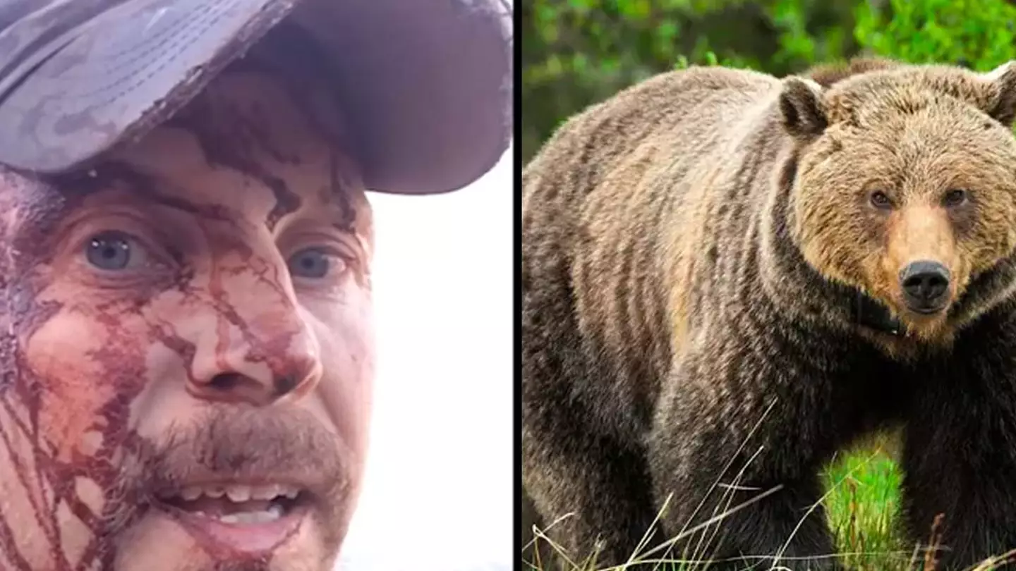 Man shares bloody aftermath of bear attack while walking to the hospital