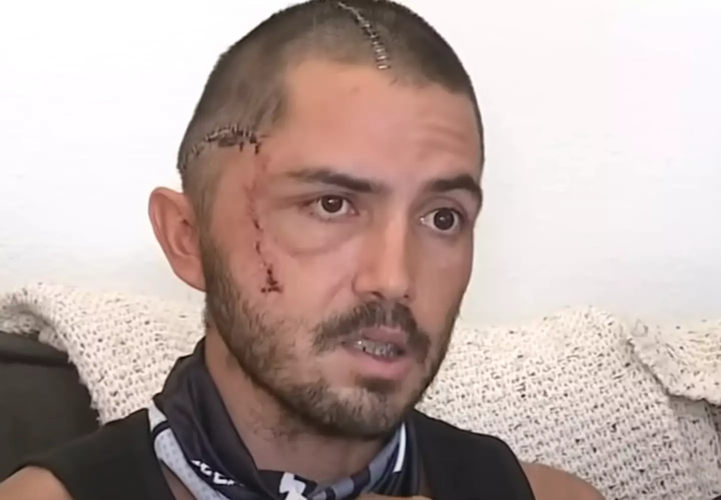 La Verde said he 'shouldn't be alive' after his attack. Youtube/ABC7
