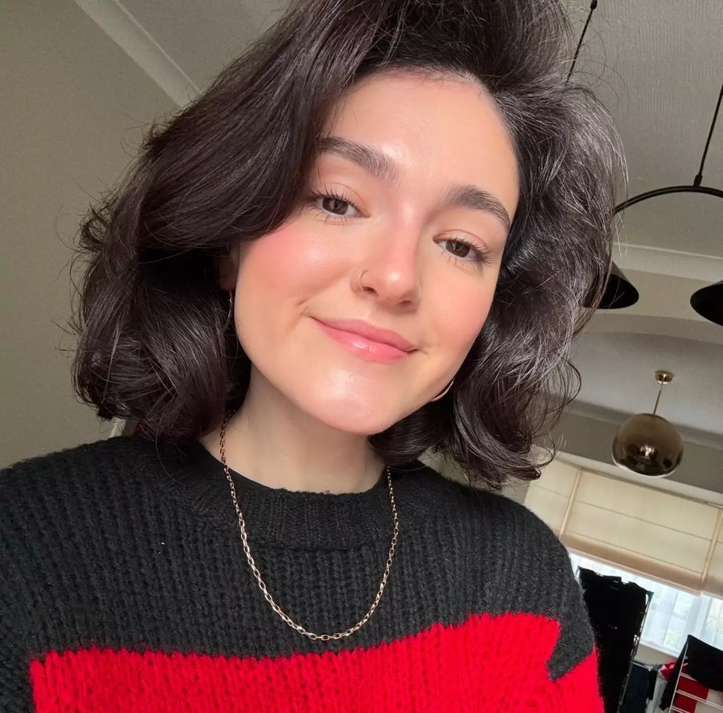 Katie Shalka was diagnosed with nutcracker syndrome after spending years in 'constant agony' (SWNS)