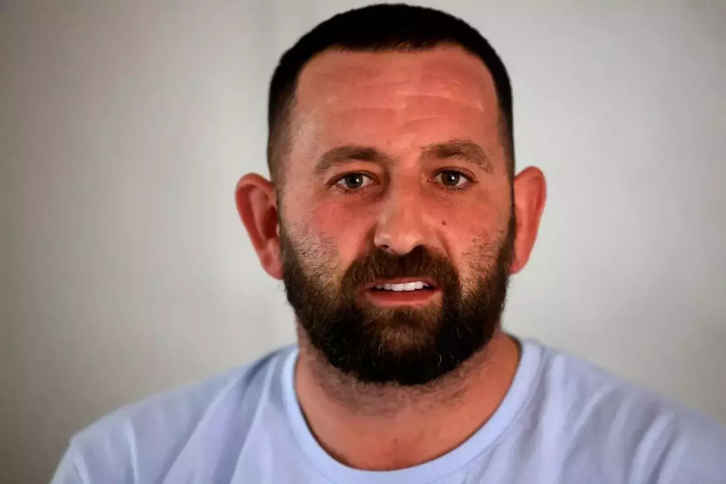 Bowen was not happy with his teeth after a number of operations in Turkey (WalesOnline/Media Wales)
