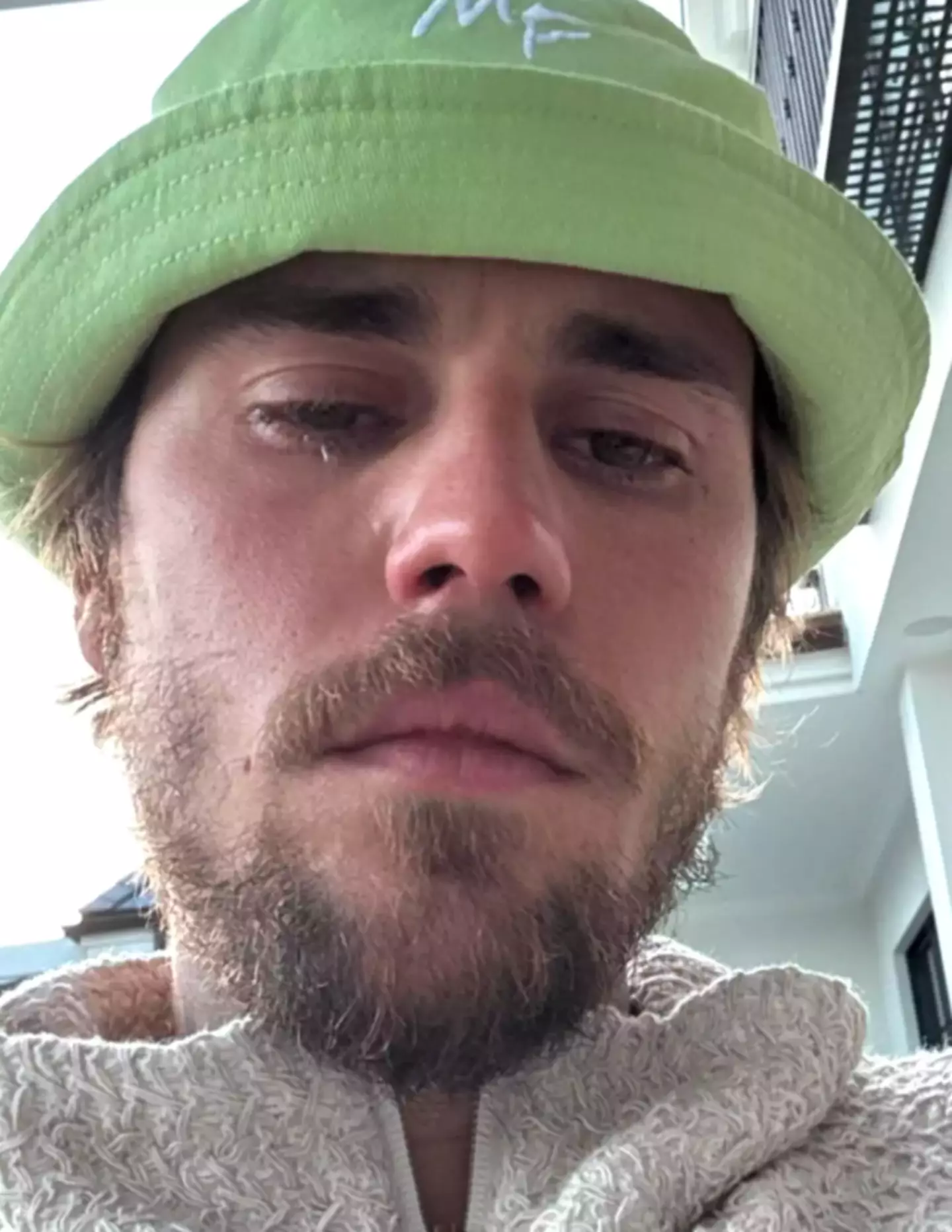 In two separate pictures, fans can see the artist shedding a tear or two. (Instagram/Justin Bieber)