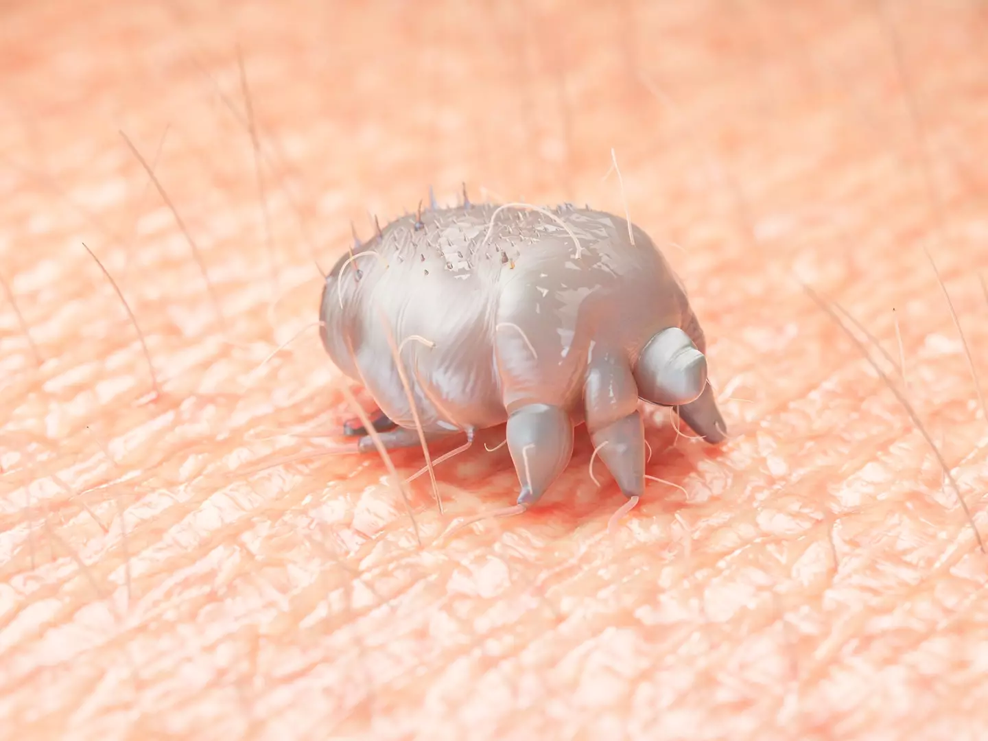 Scabies is caused by tiny mites burrowing into your skin (Getty Stock Photo)
