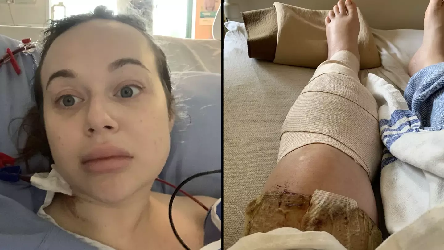 Woman almost needed legs amputated after waking up from drinking 'a lot' of vodka on night out