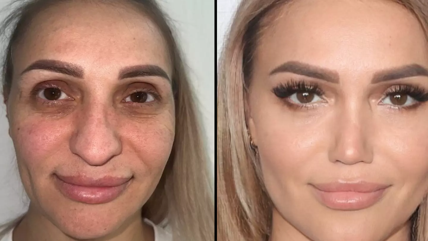 People left stunned at woman's dramatic surgery transformation saying her 'phone will no longer unlock'