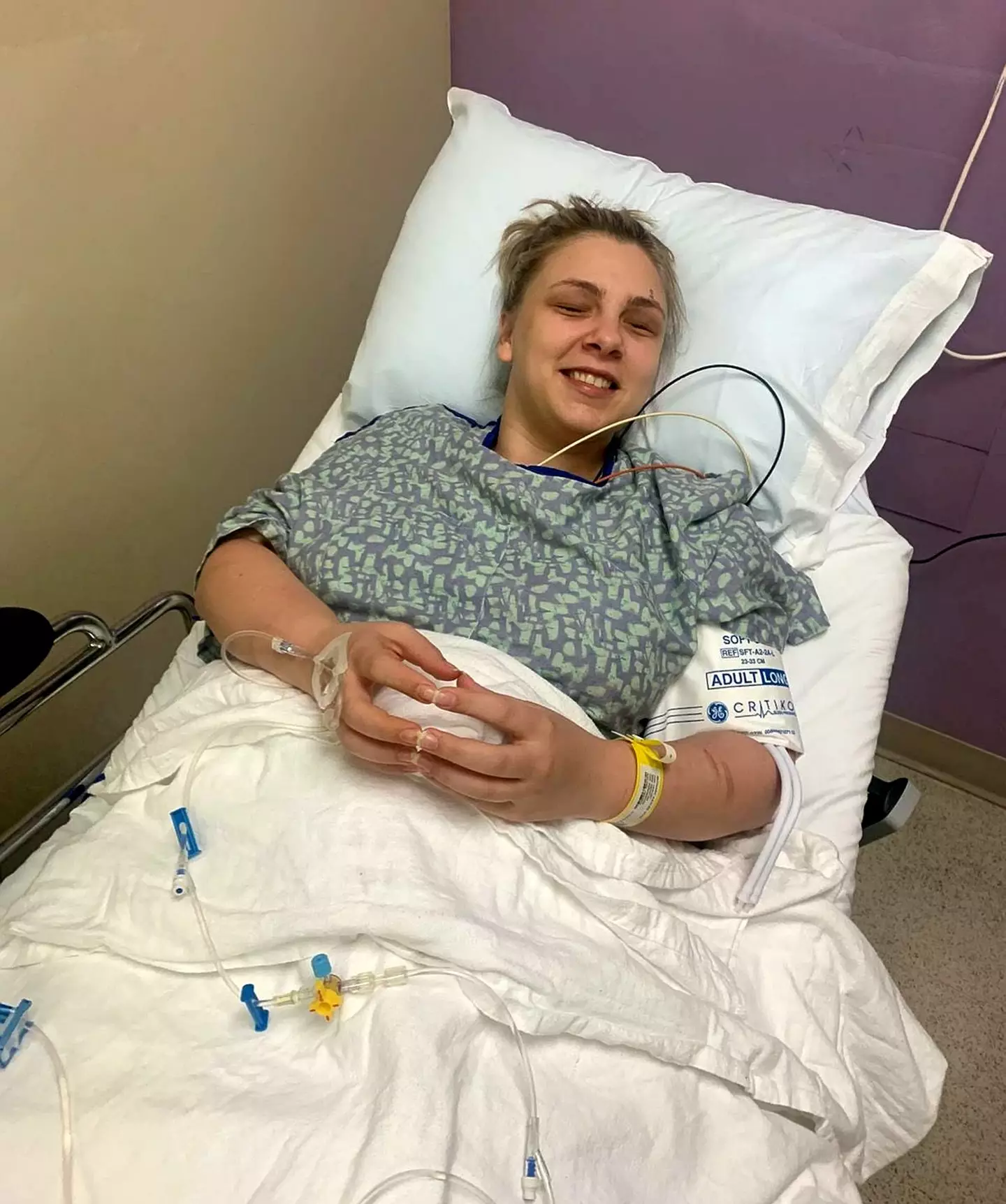 Kaylee tore out her own eyes while high on drugs in 2018 (SWNS)