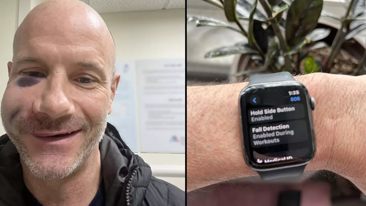 Man says Apple watch 'saved his life' after bike crash that left him 'looking like monster'