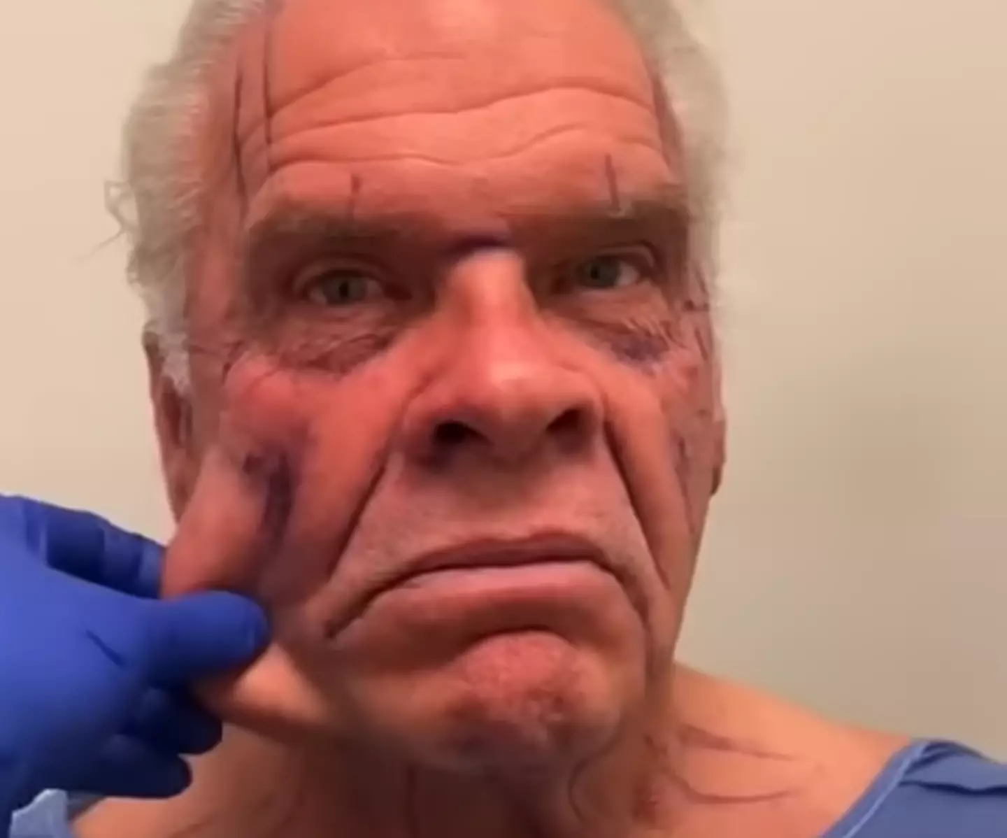 Another 'before' image... (YouTube/DrKassir)