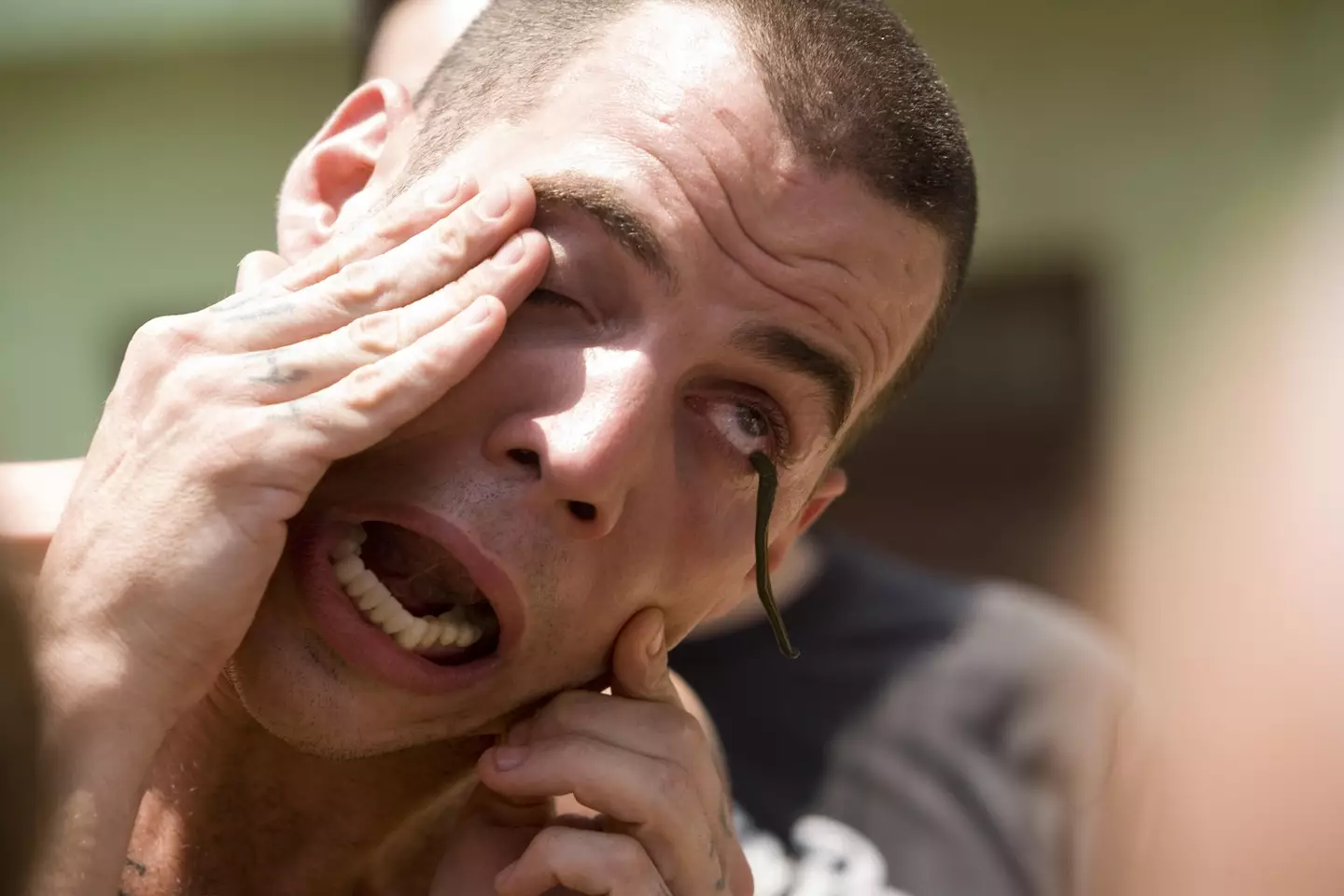 Steve-O has  battled with mental health issues along with addictions to cocaine, alcohol, ketamine, PCP and nitrous oxide.