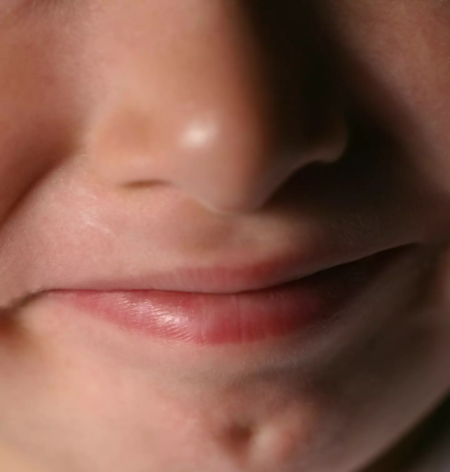 Chin dimples are making people feel 'nauseous'.